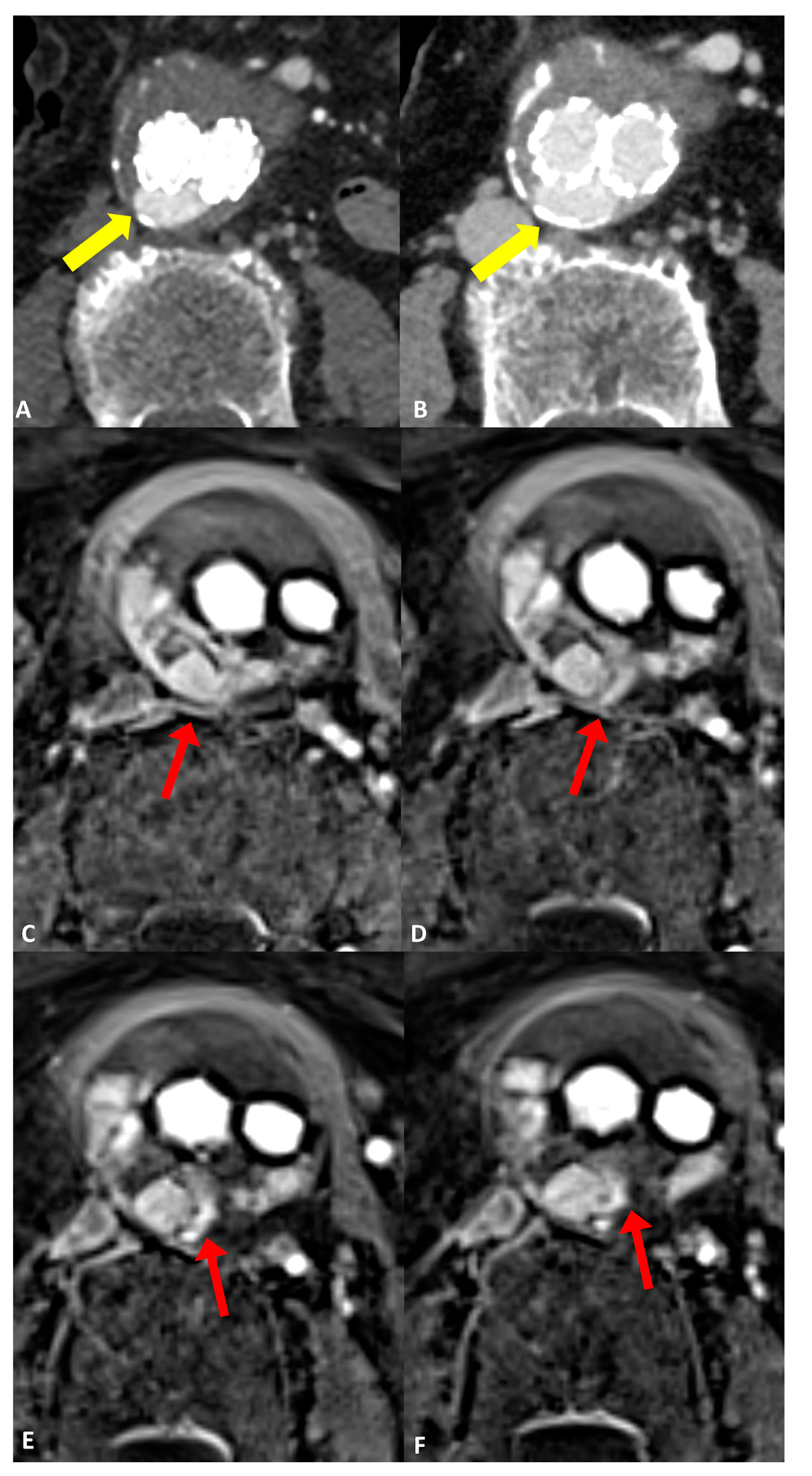 Jcm 13 02913 g003 Jcm 13 02913 g003