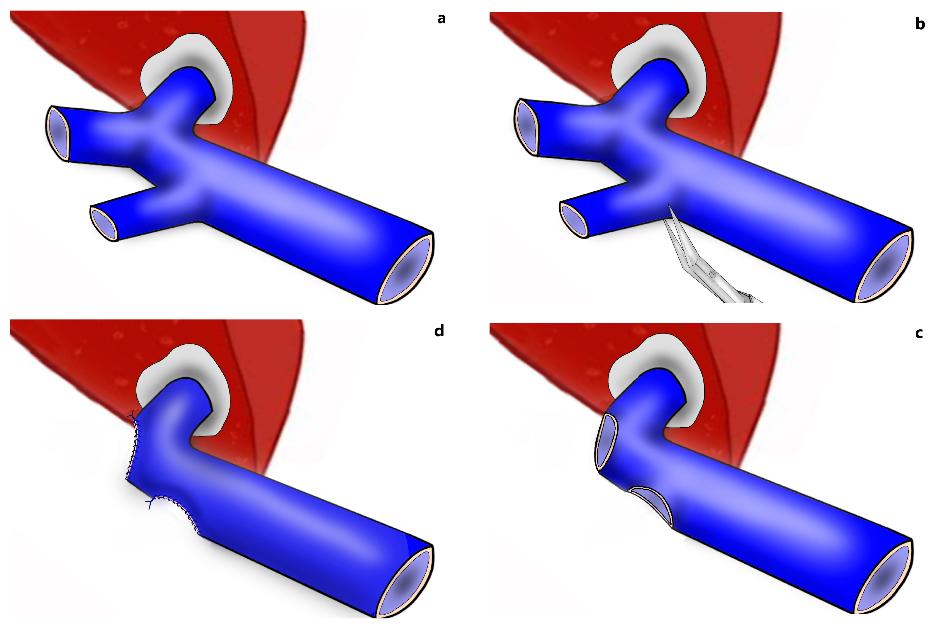 Jcm 13 02924 g001 Jcm 13 02924 g001