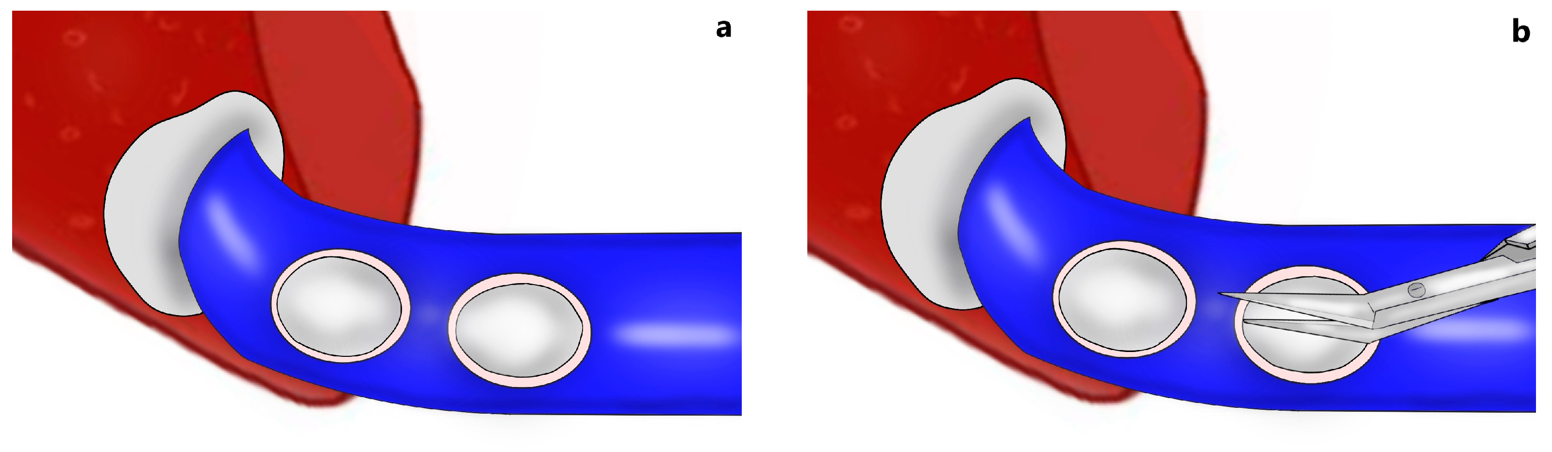 Jcm 13 02924 g002a Jcm 13 02924 g002a