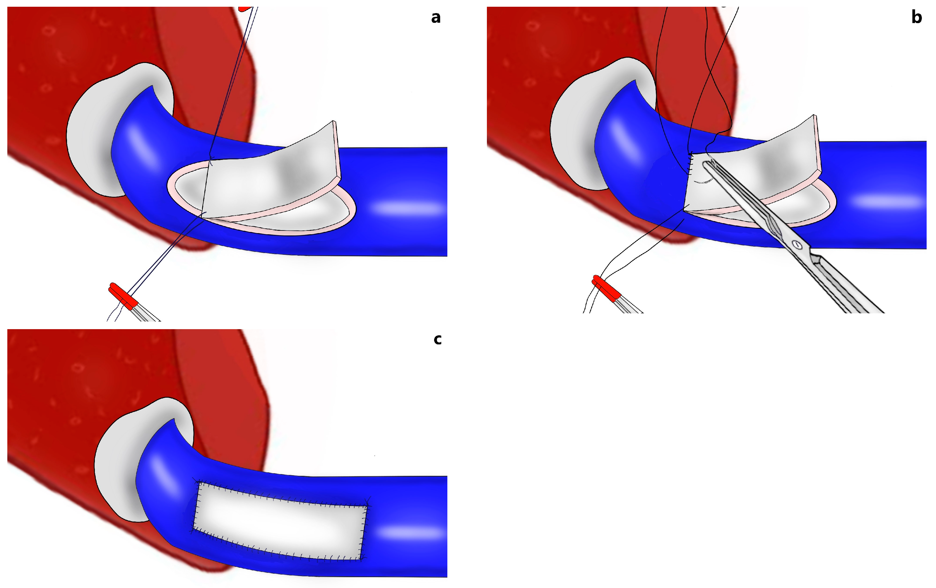 Jcm 13 02924 g003 Jcm 13 02924 g003