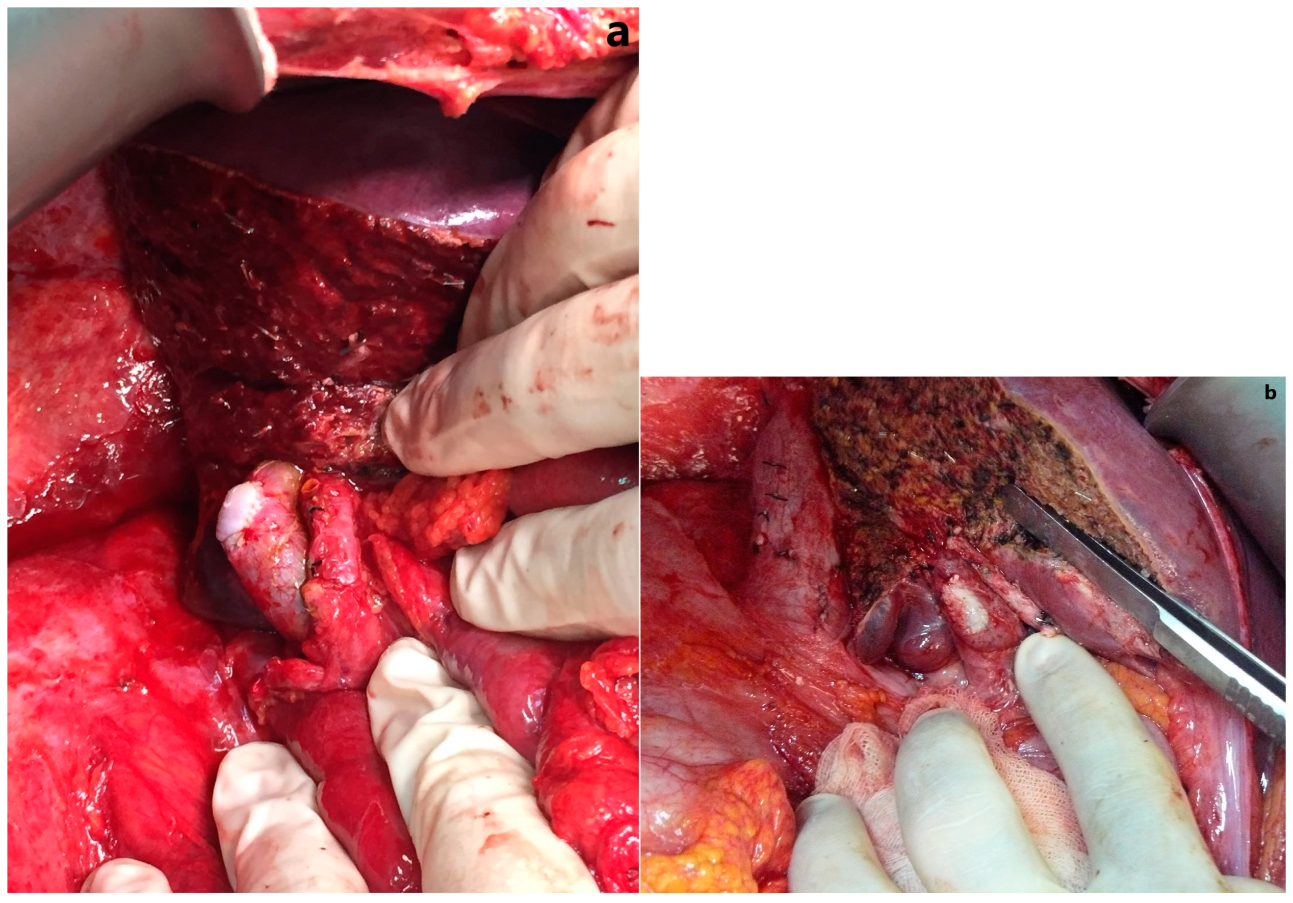 Jcm 13 02924 g004 Jcm 13 02924 g004