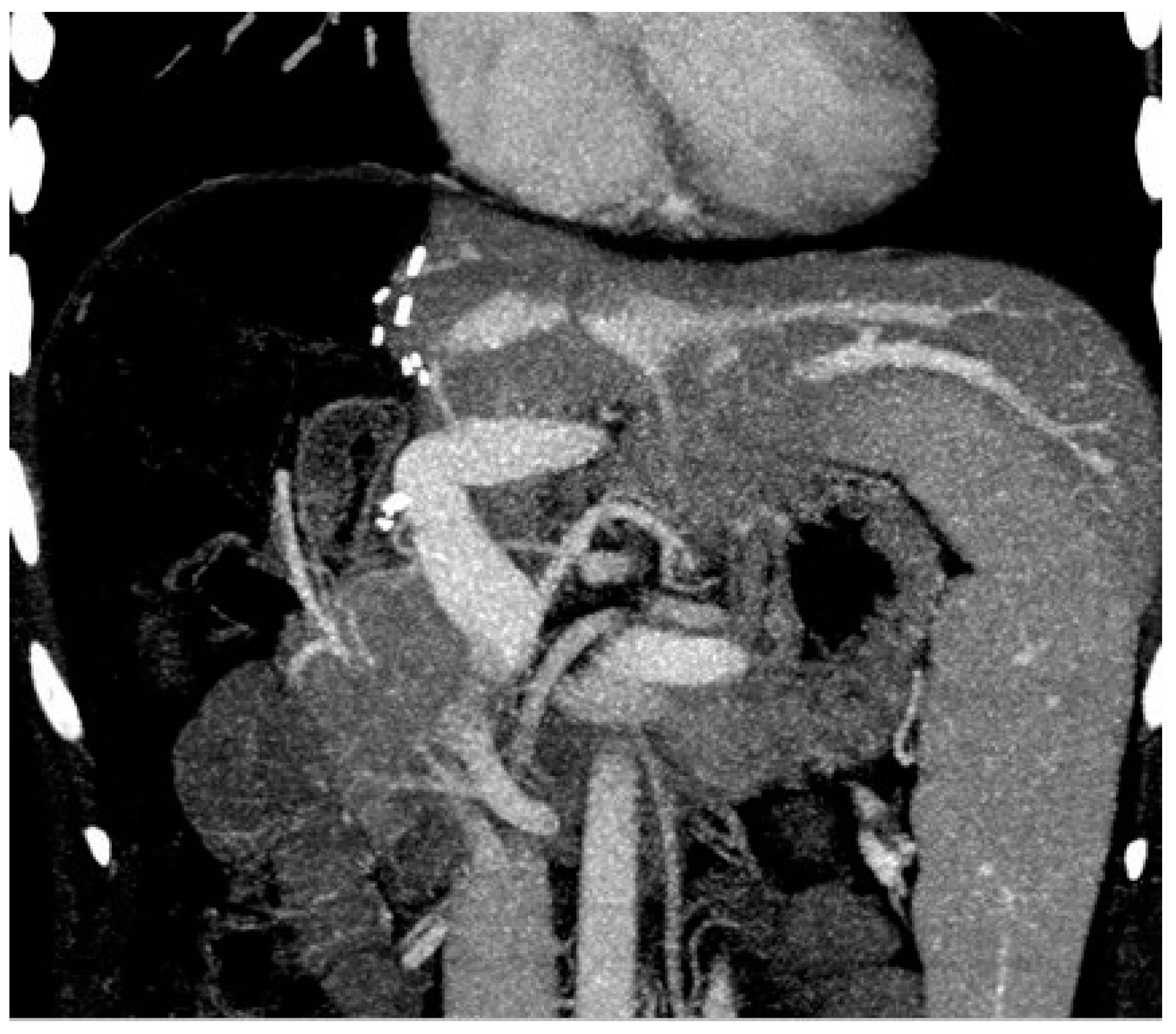Jcm 13 02924 g005 Jcm 13 02924 g005