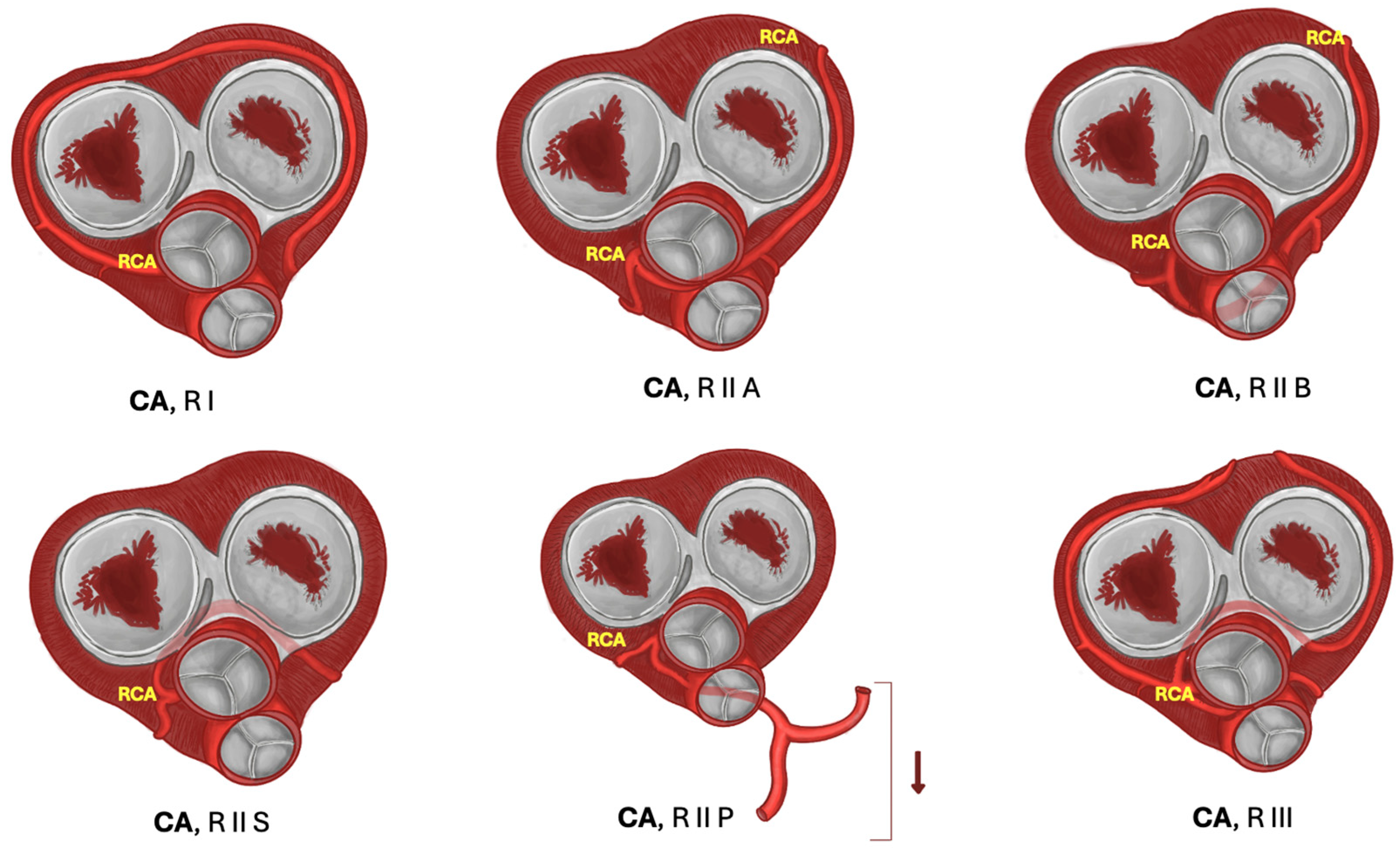 Jcm 13 03085 g003 Jcm 13 03085 g003