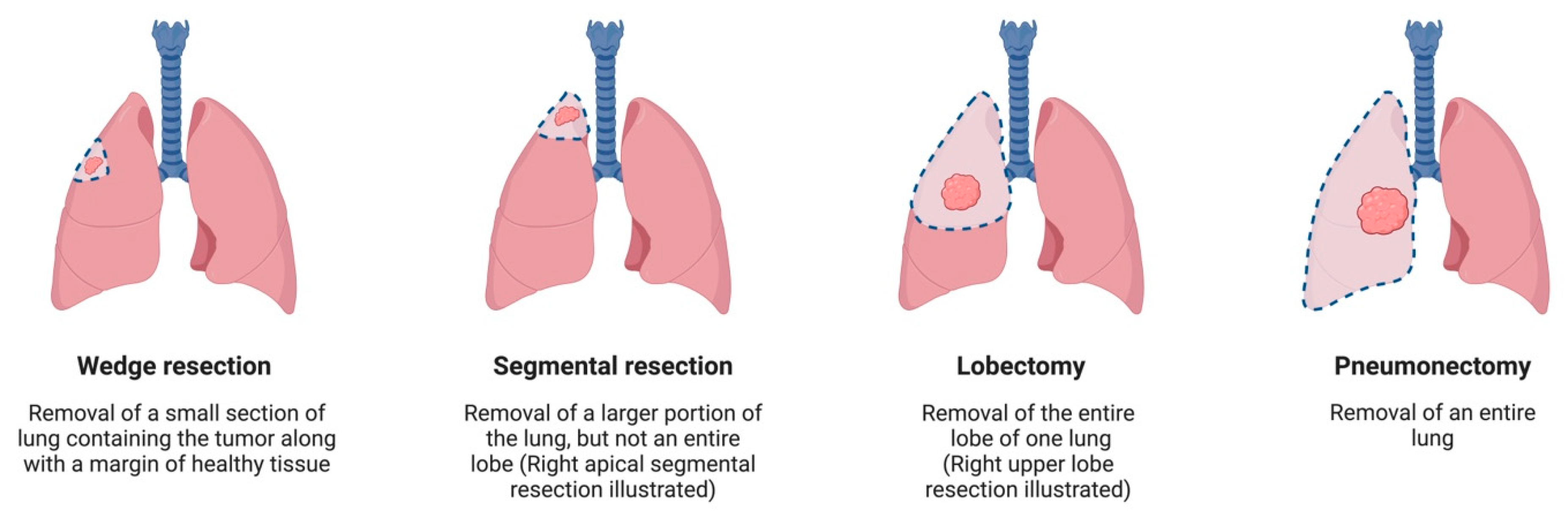 Jcm 13 03354 g001 Jcm 13 03354 g001