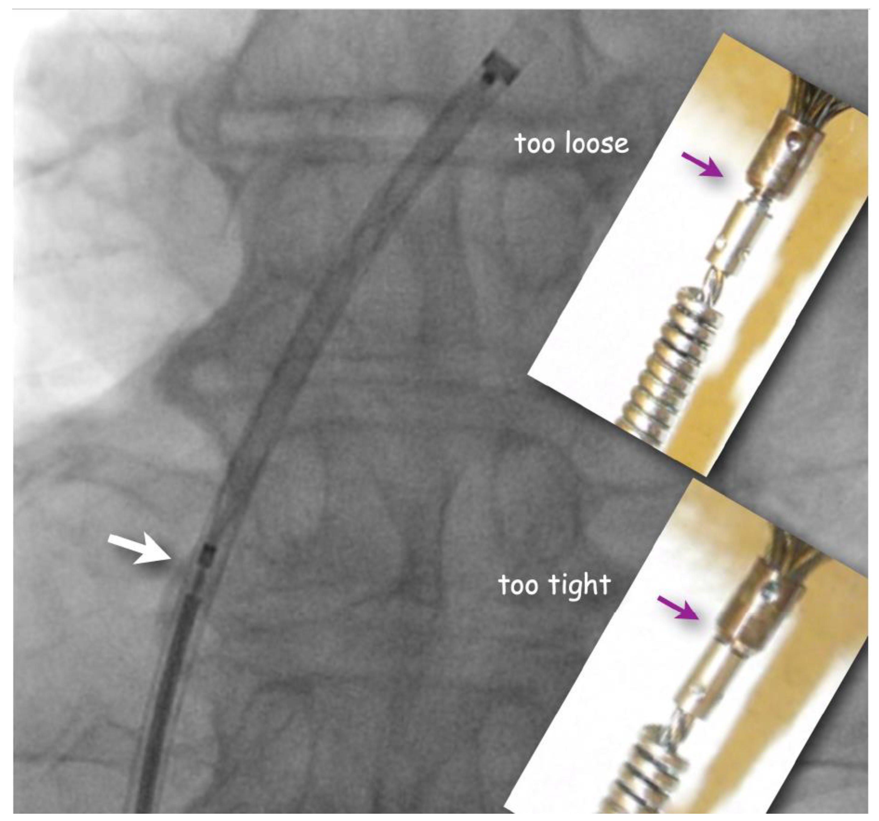 Jcm 13 03355 g002 Jcm 13 03355 g002