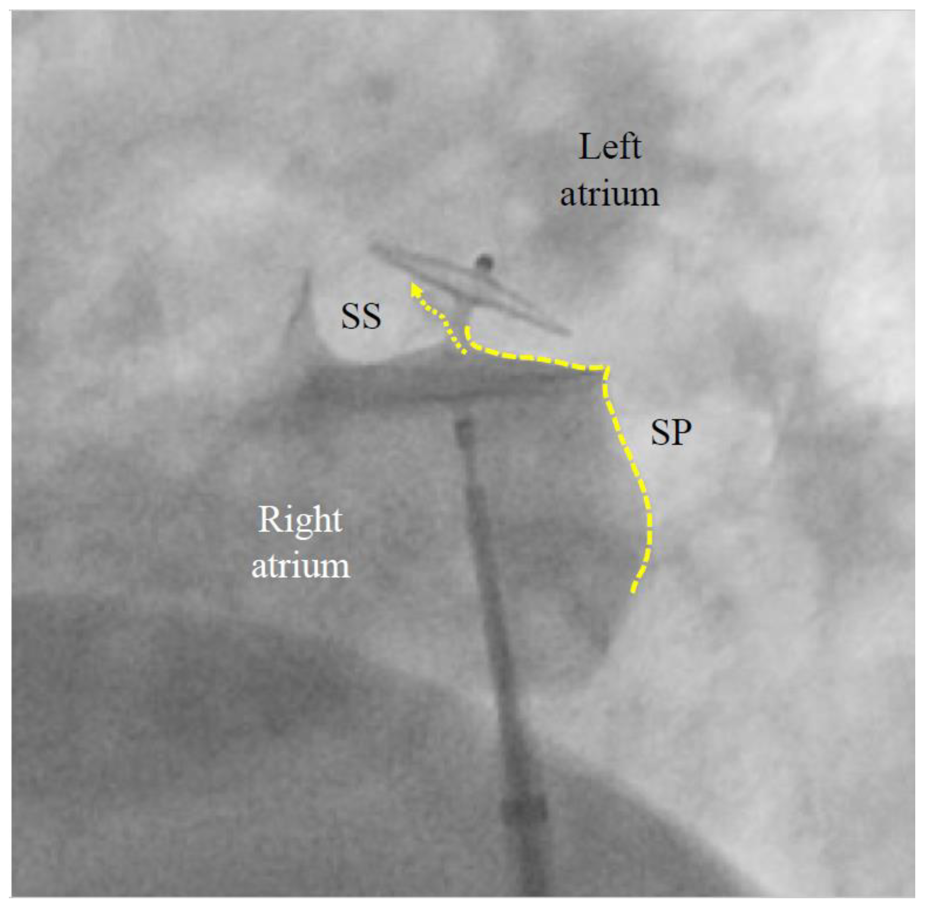 Jcm 13 03355 g003 Jcm 13 03355 g003
