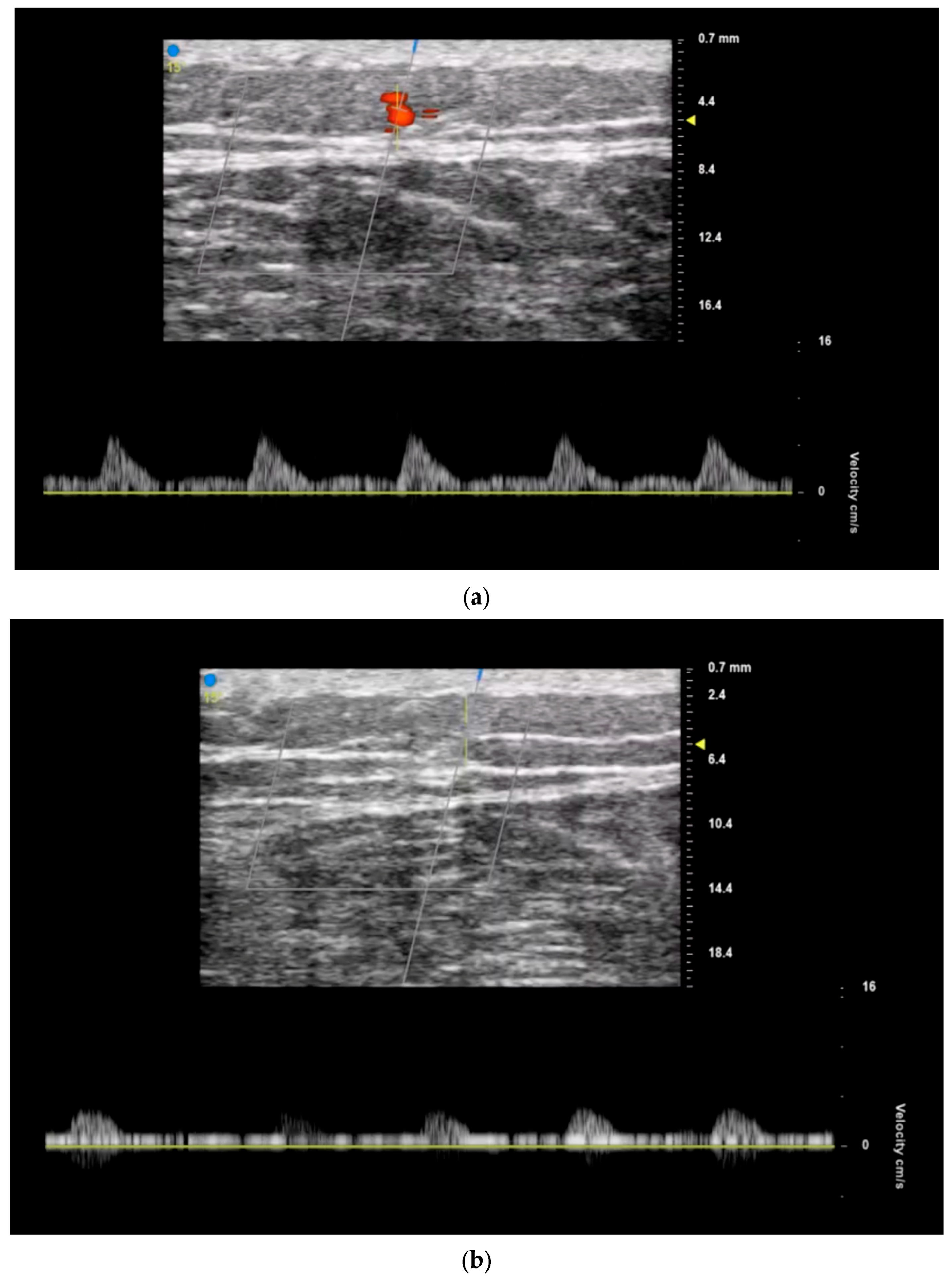 Jcm 13 03412 g003 Jcm 13 03412 g003