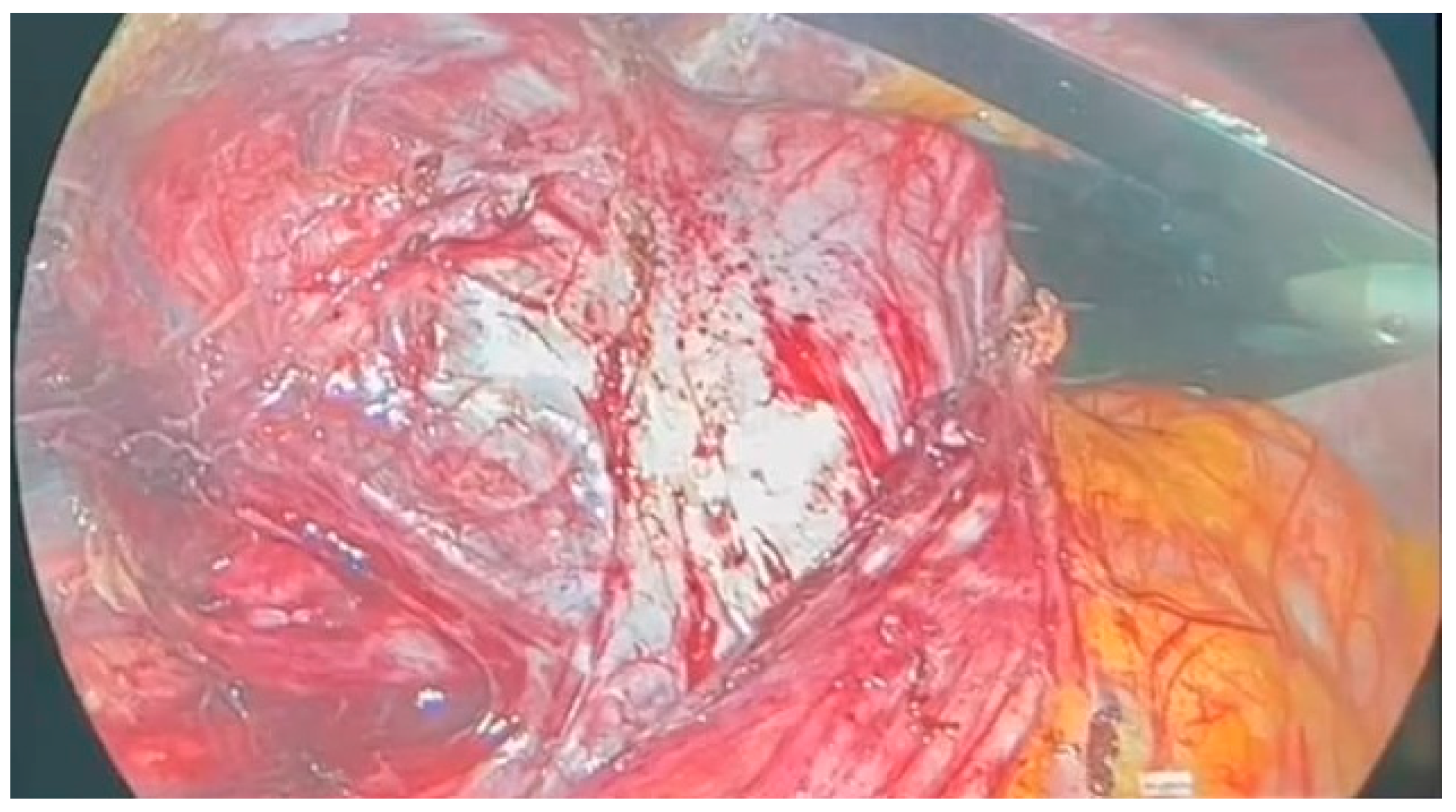 Jcm 13 03499 g002 Jcm 13 03499 g002