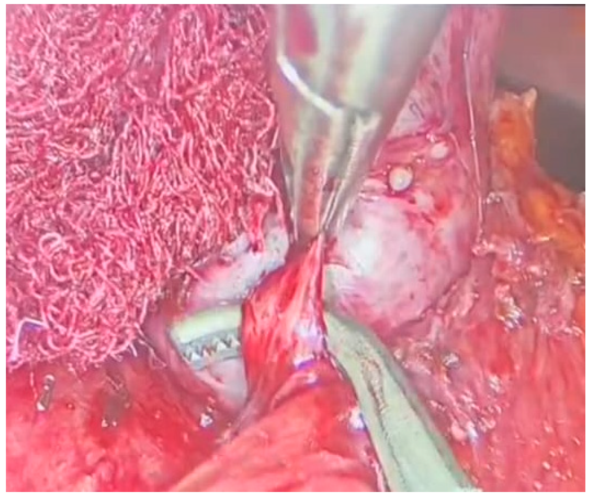 Jcm 13 03499 g003 Jcm 13 03499 g003