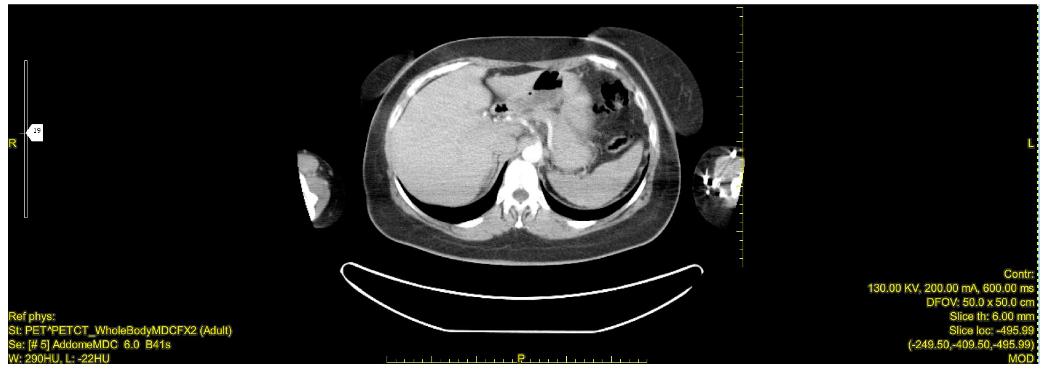 Jcm 13 03499 g005 Jcm 13 03499 g005