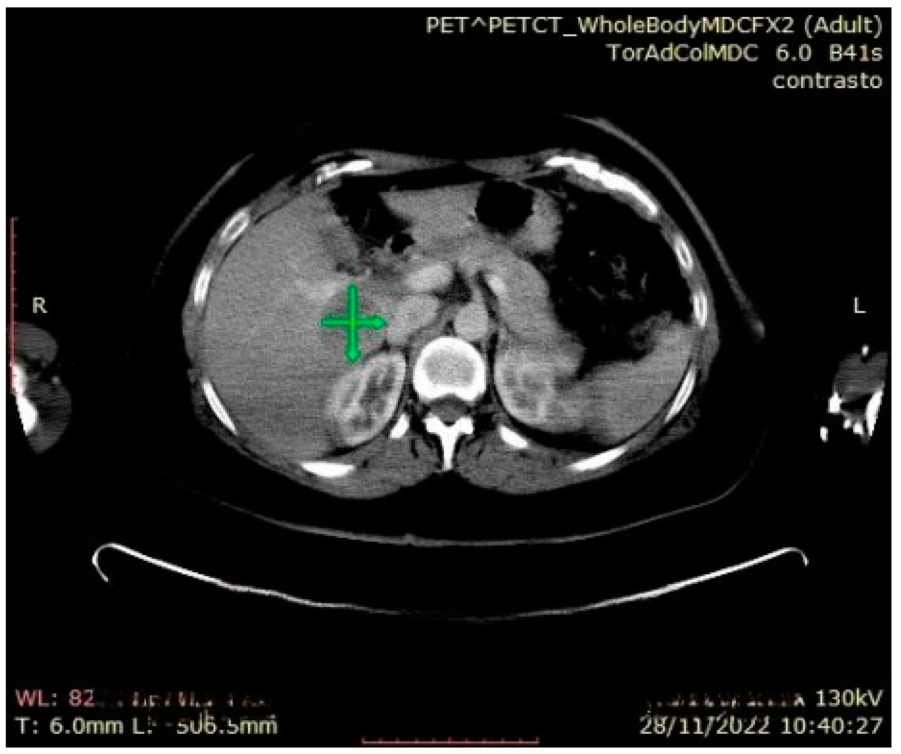 Jcm 13 03499 g007 Jcm 13 03499 g007