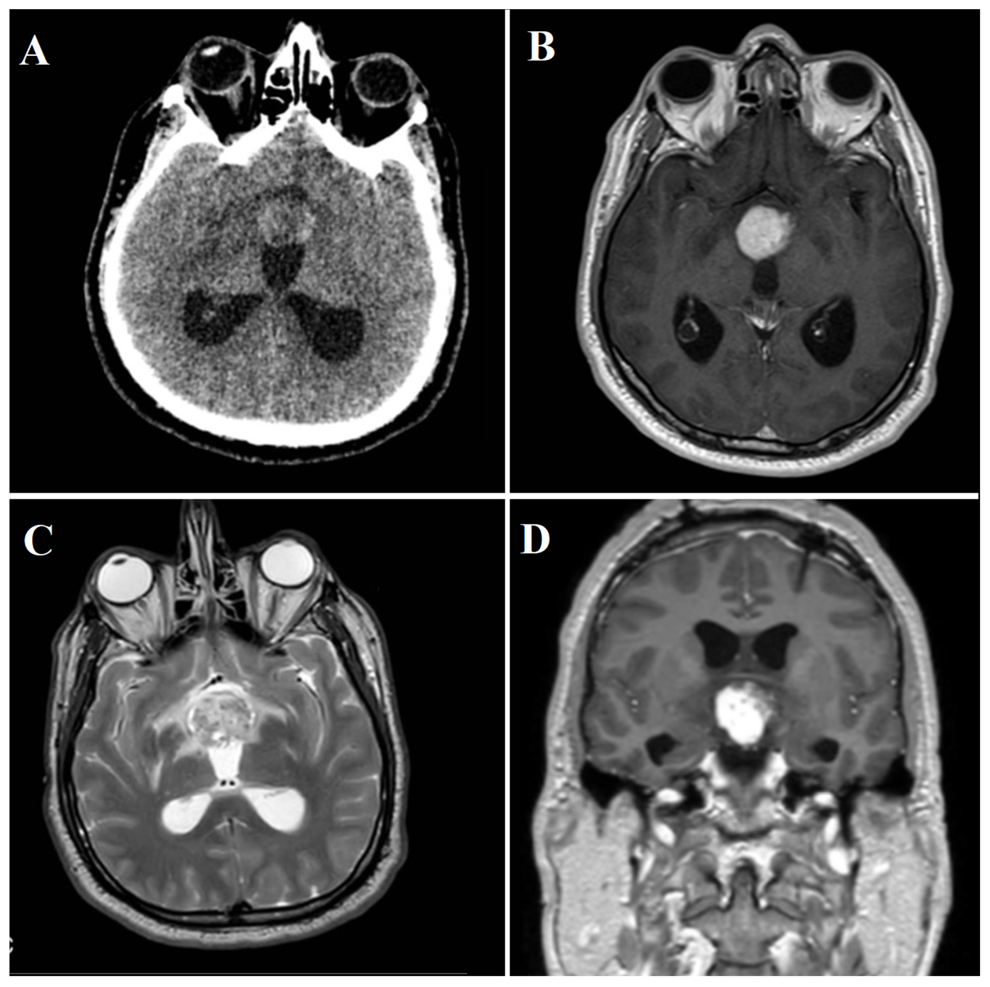 Jcm 13 03536 g006 Jcm 13 03536 g006