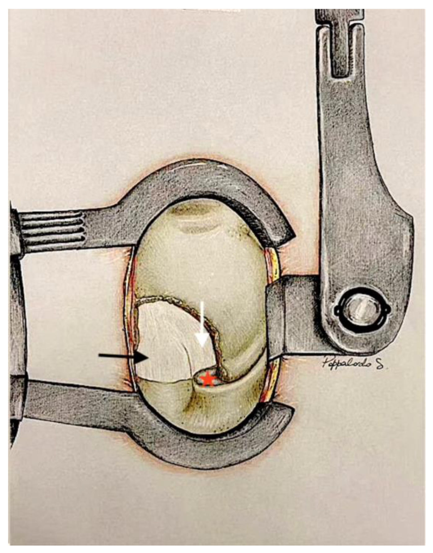 Jcm 13 03571 g004 Jcm 13 03571 g004