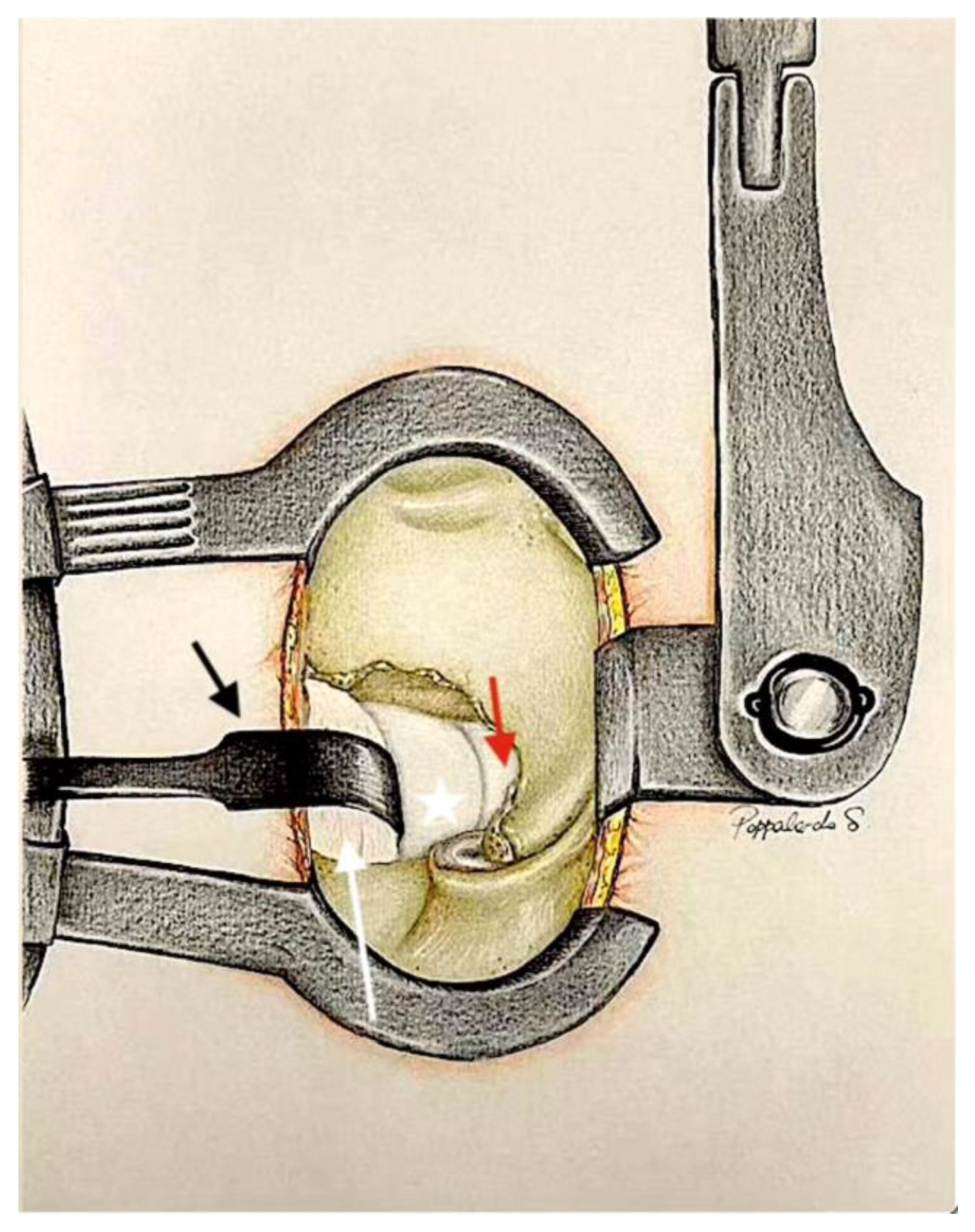 Jcm 13 03571 g005 Jcm 13 03571 g005