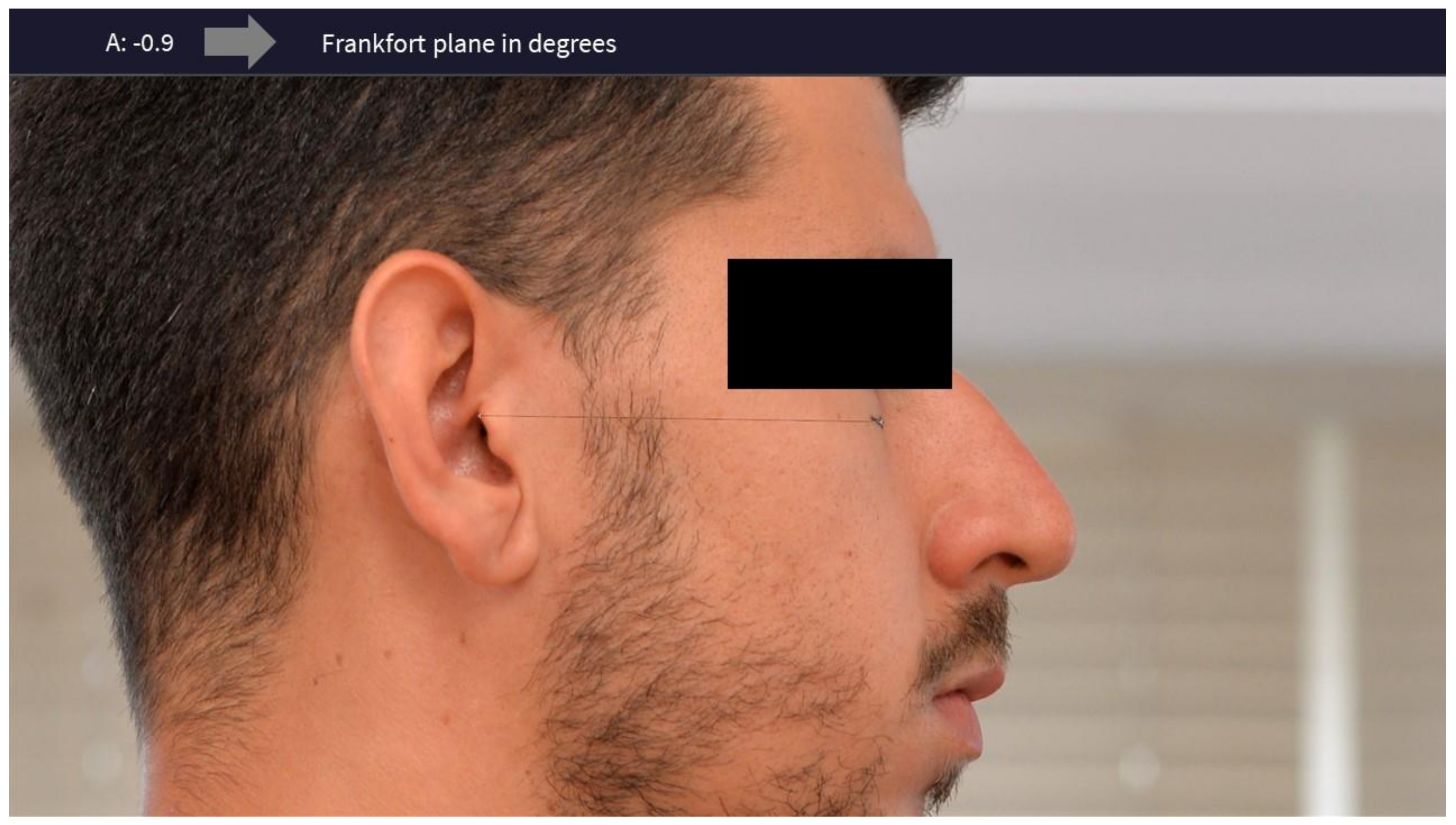 Jcm 13 03614 g003 Jcm 13 03614 g003