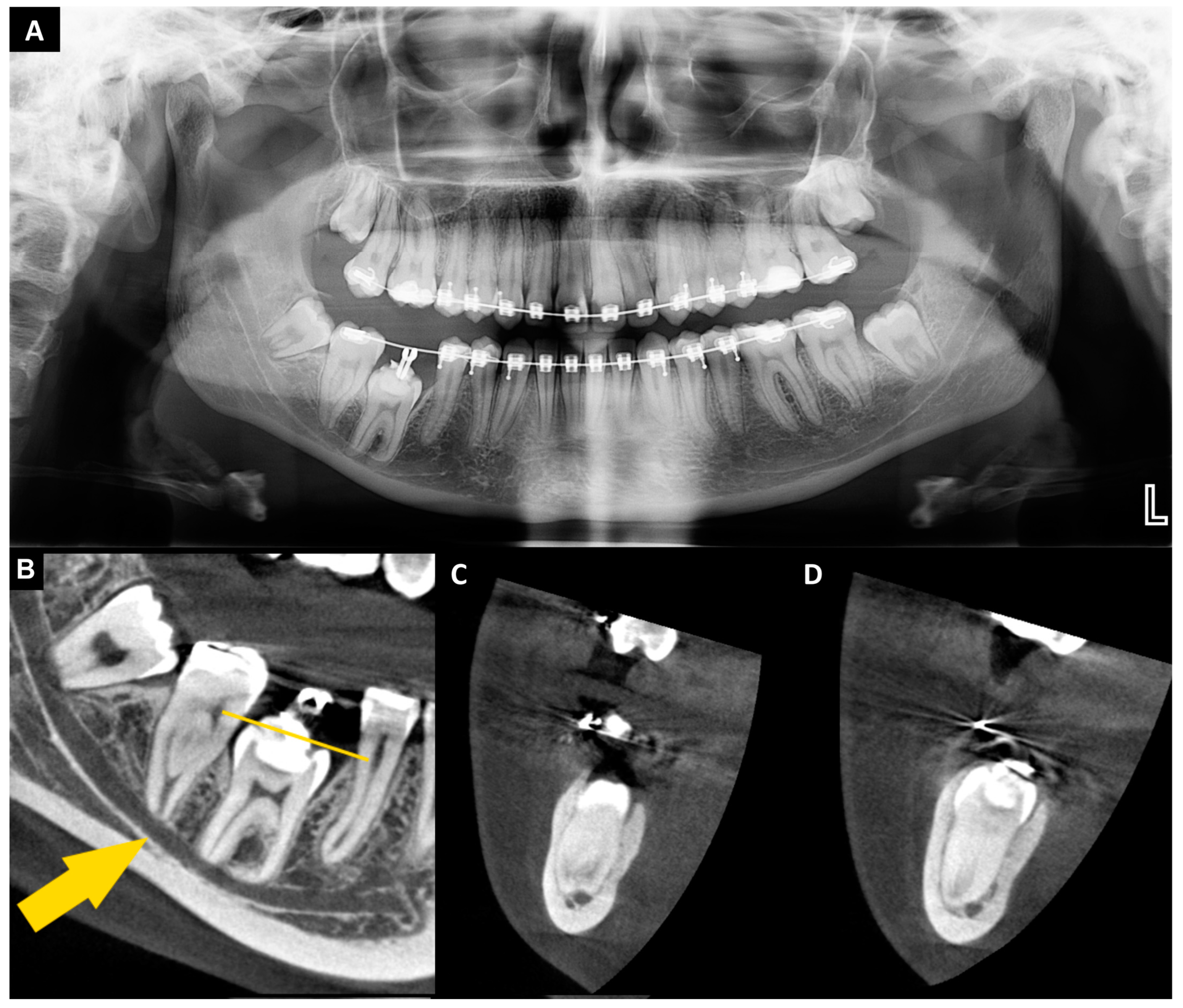 Jcm 13 03902 g001 Jcm 13 03902 g001