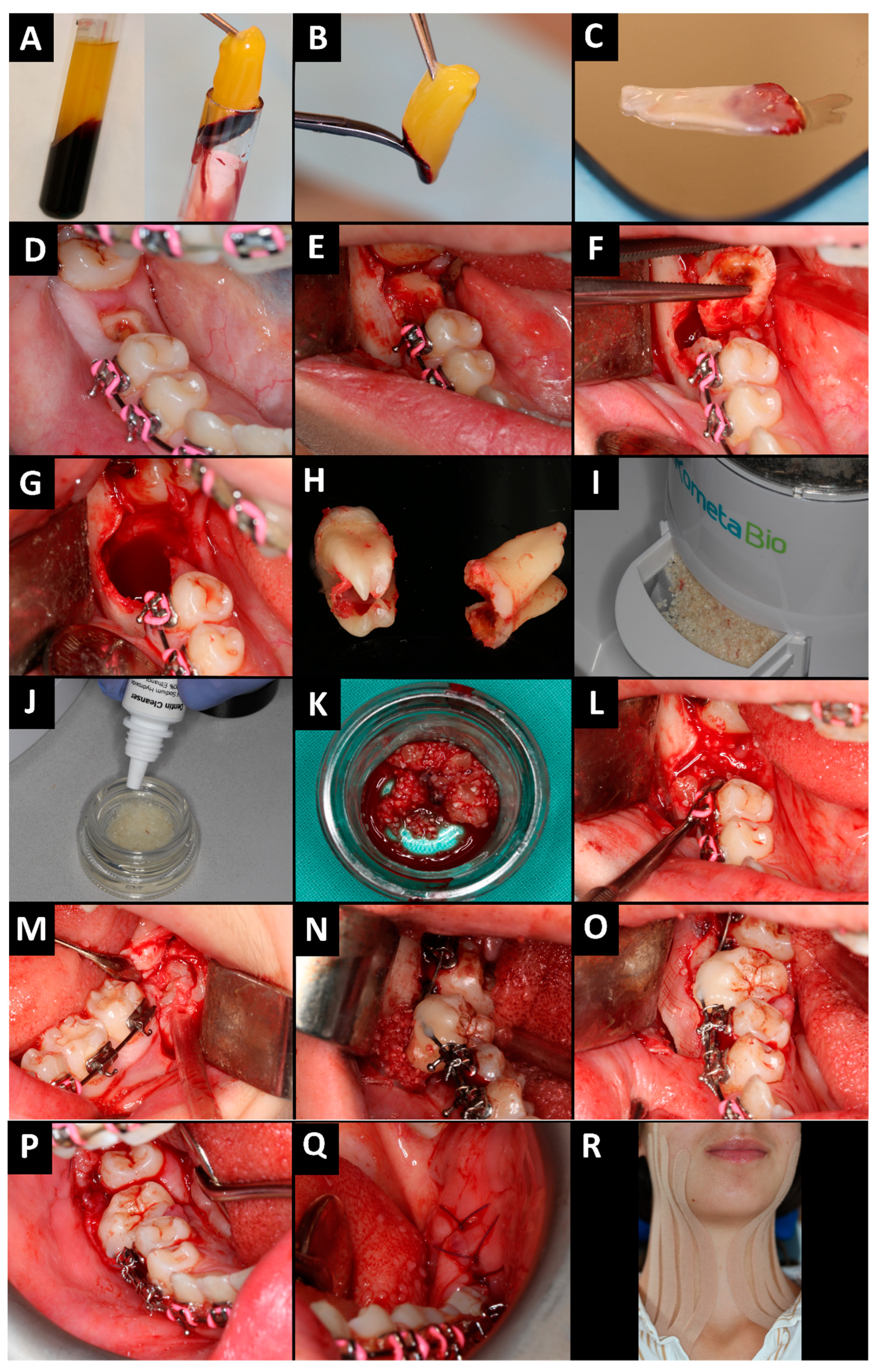 Jcm 13 03902 g002 Jcm 13 03902 g002