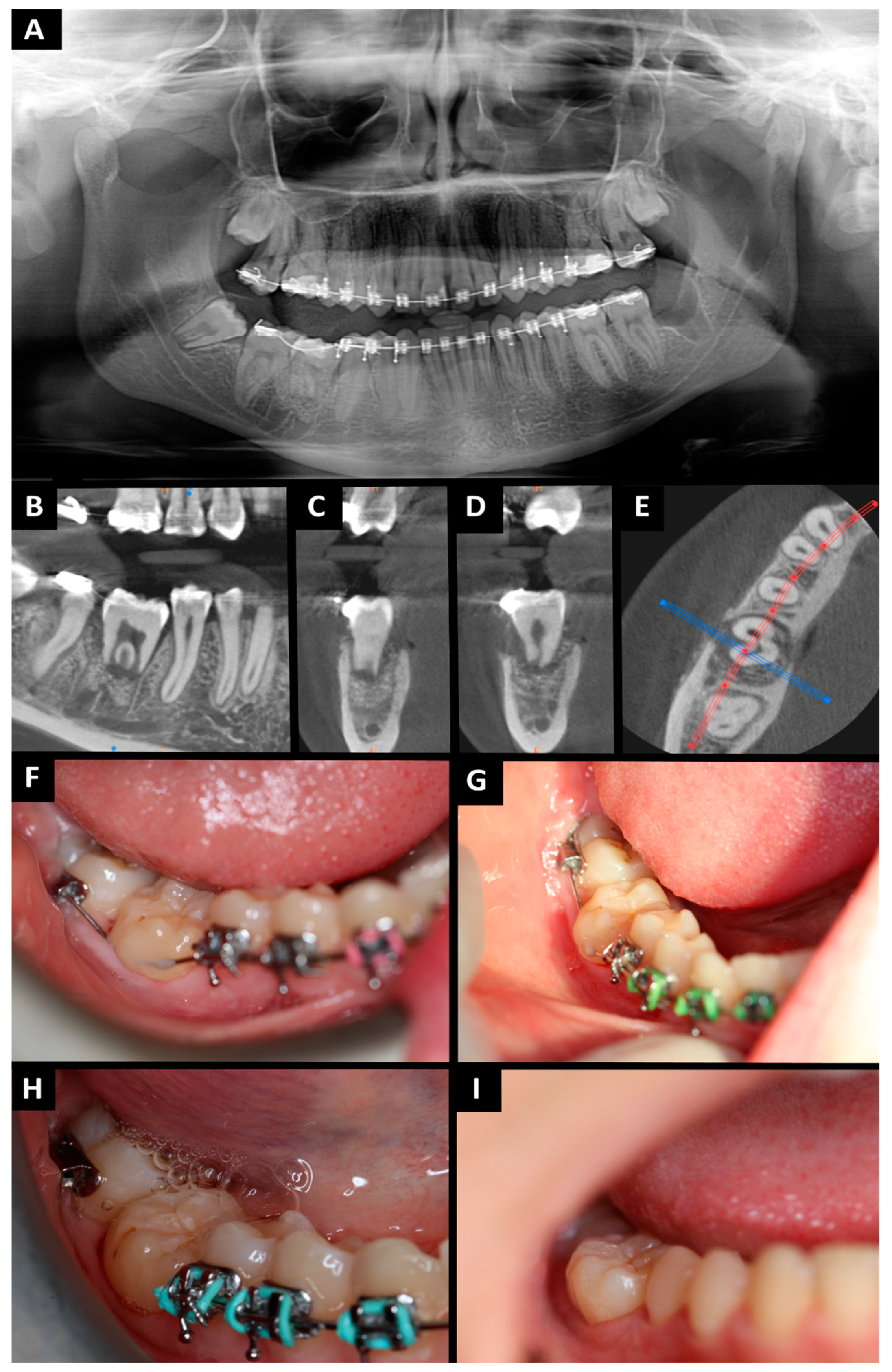 Jcm 13 03902 g003 Jcm 13 03902 g003