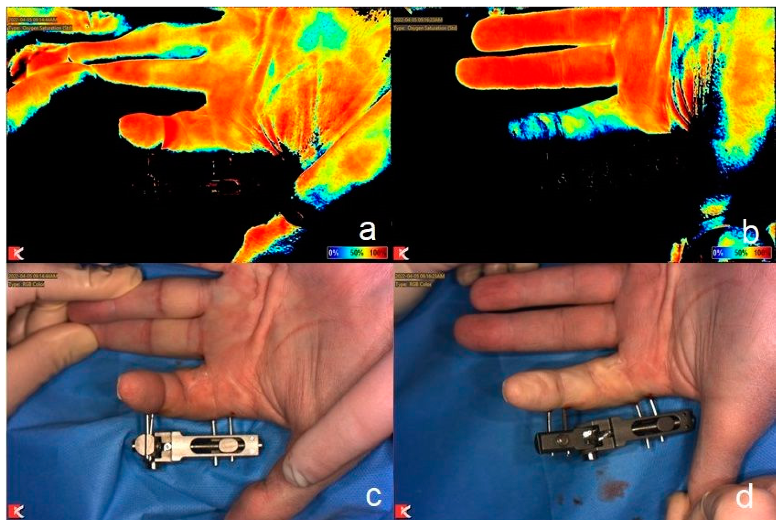 Jcm 13 04025 g001 Jcm 13 04025 g001