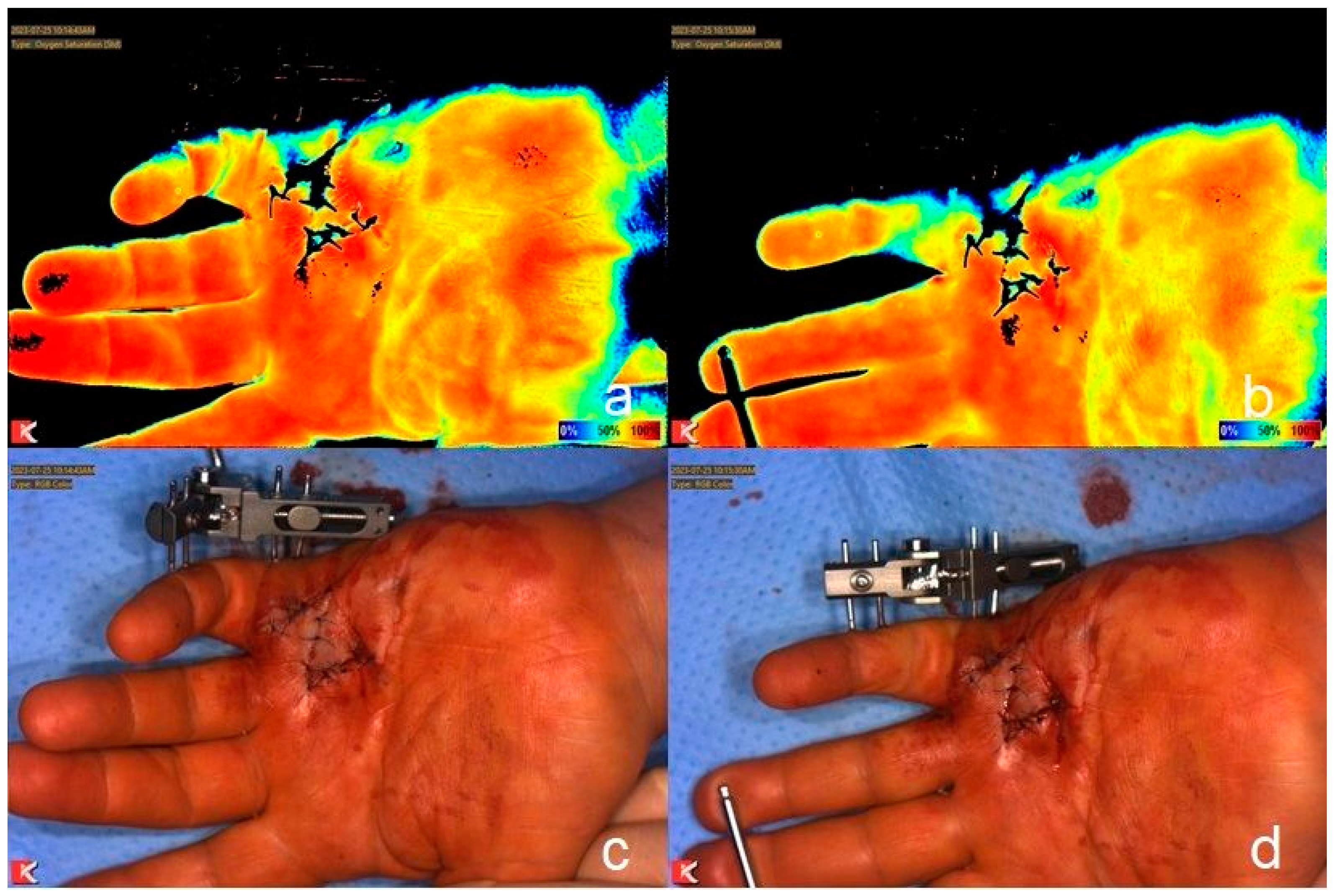 Jcm 13 04025 g002 Jcm 13 04025 g002