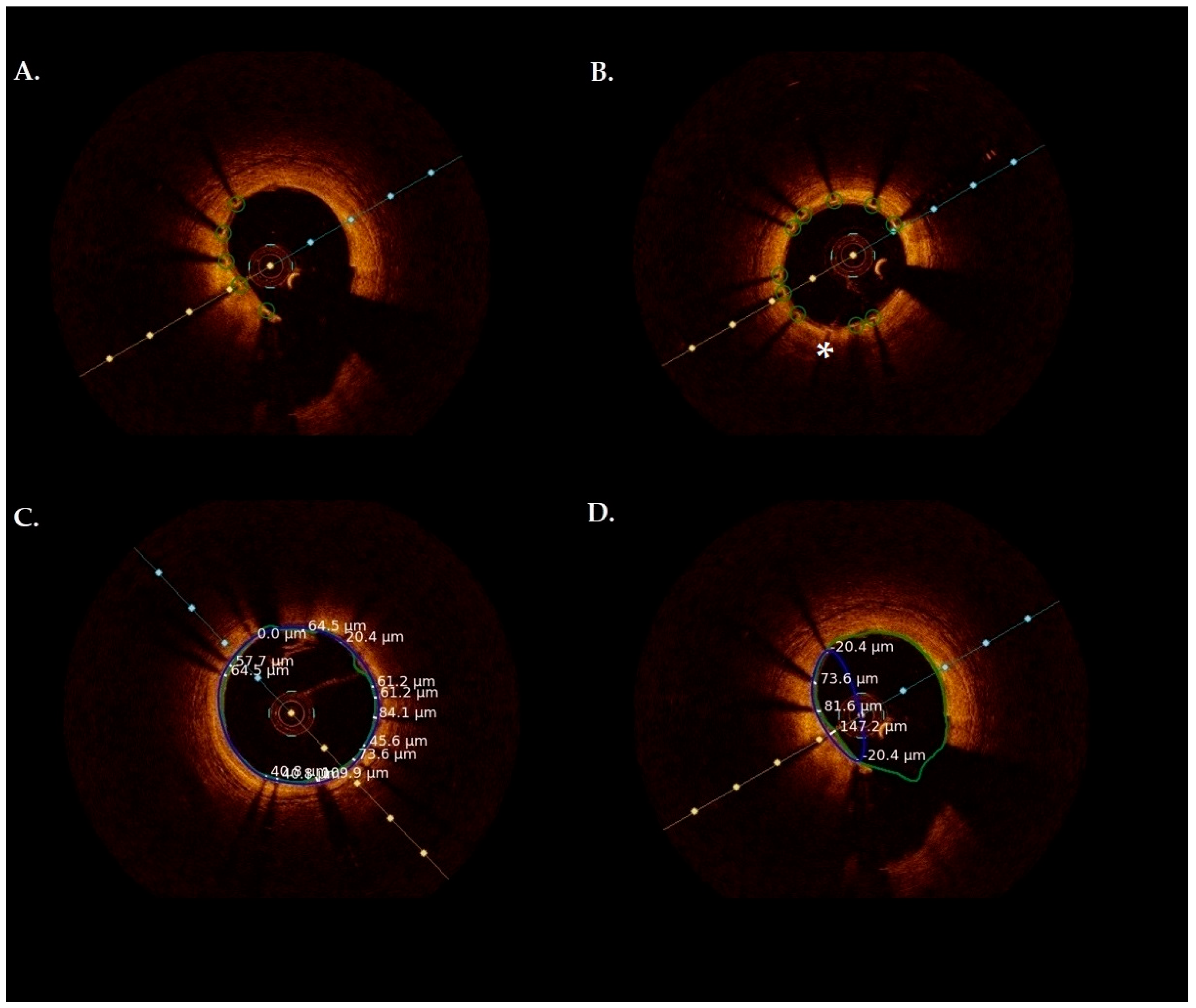 Jcm 13 04336 g002 Jcm 13 04336 g002