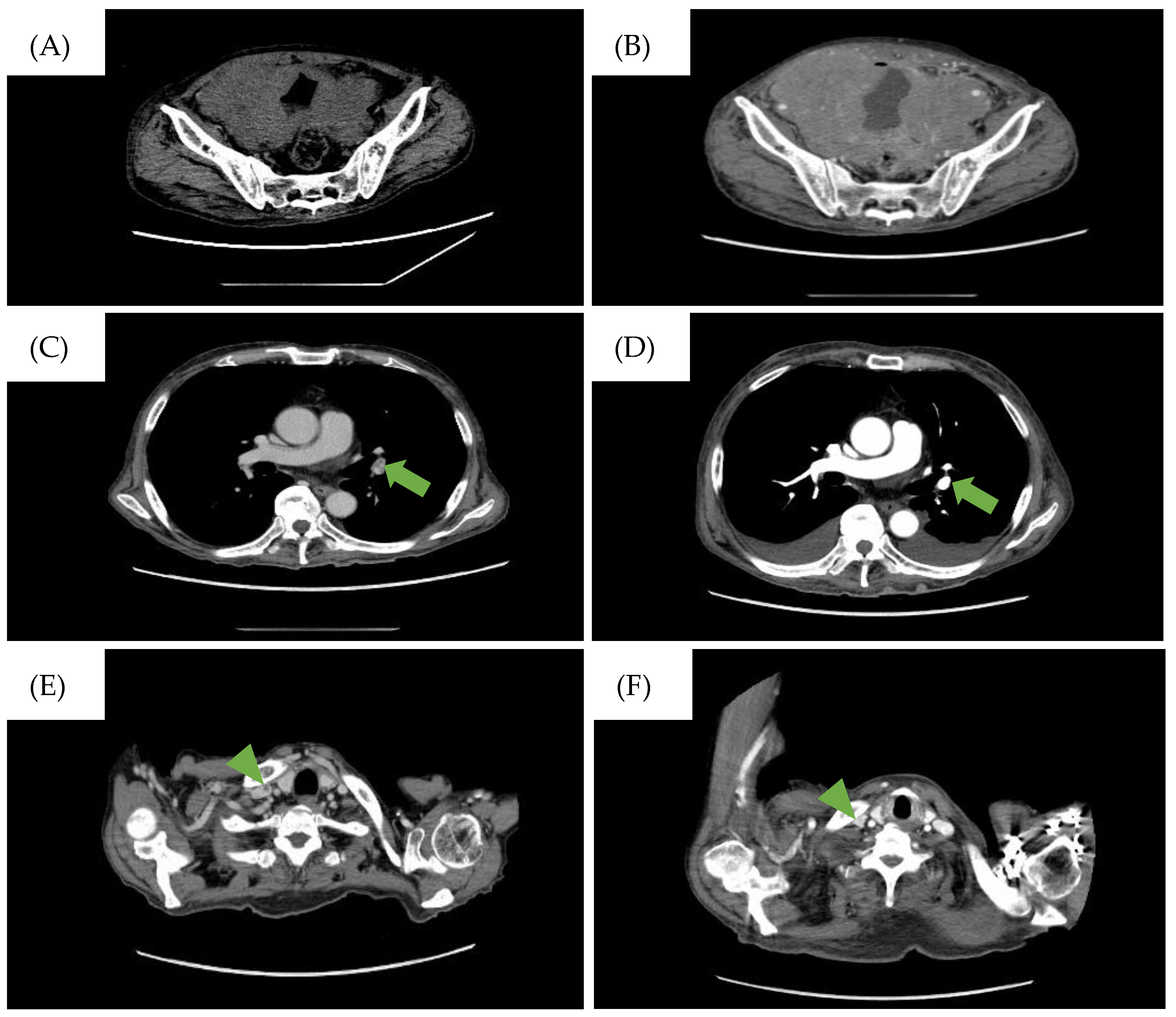 Jcm 13 04340 g001 Jcm 13 04340 g001
