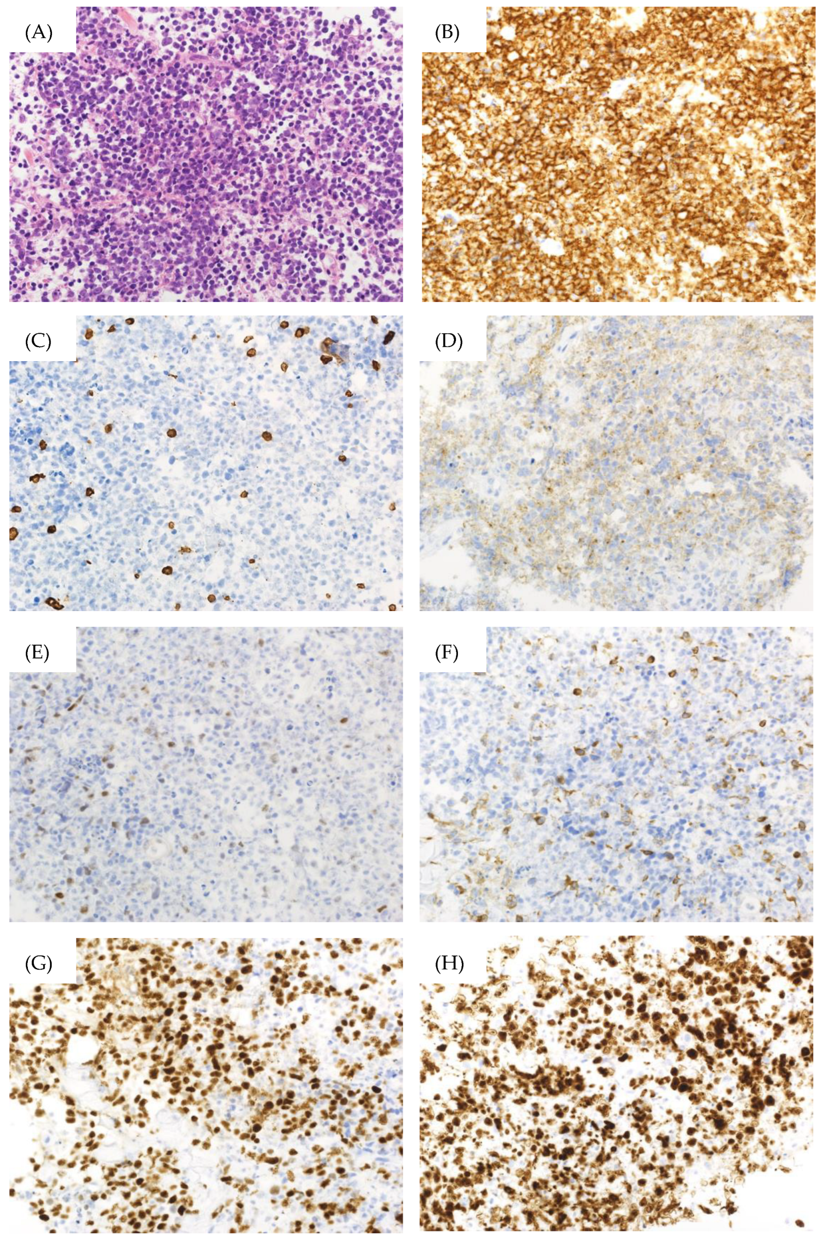 Jcm 13 04340 g002 Jcm 13 04340 g002