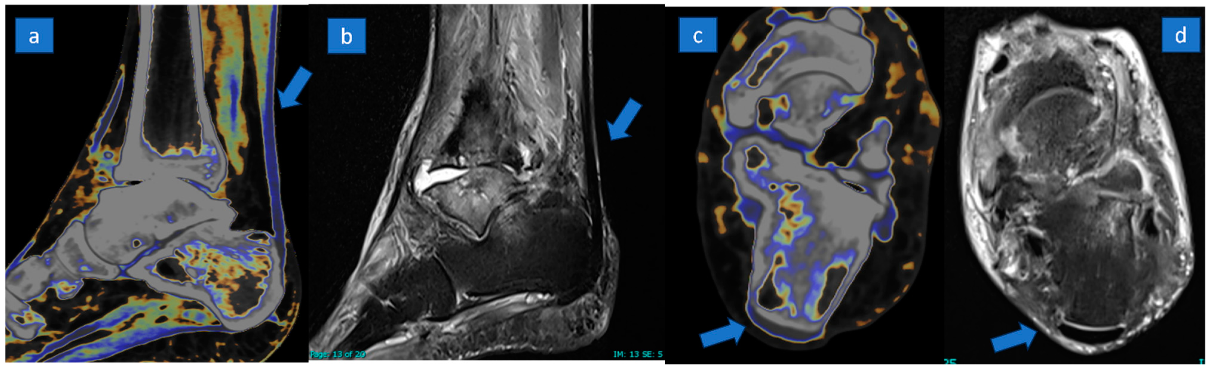 Jcm 13 04426 g002 Jcm 13 04426 g002