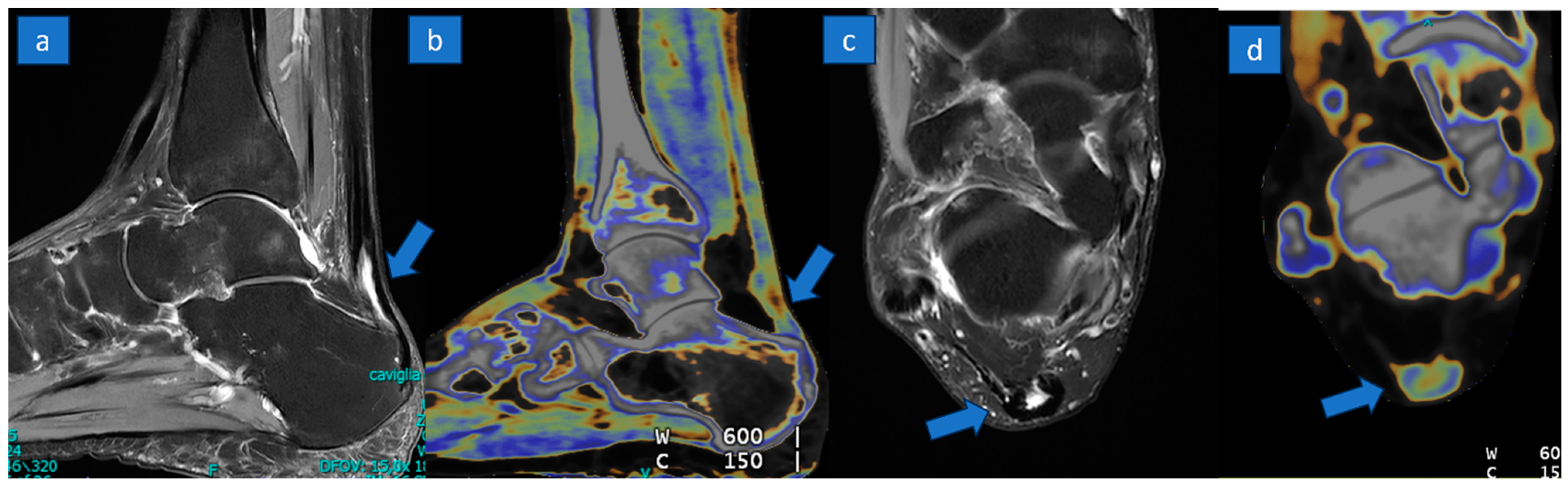 Jcm 13 04426 g004 Jcm 13 04426 g004
