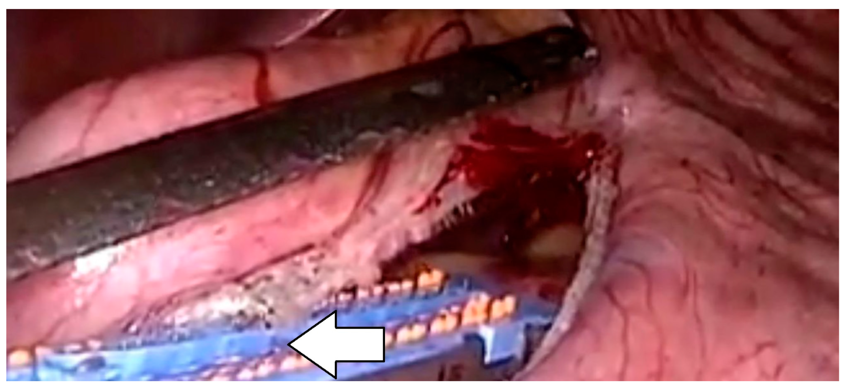 Jcm 13 04456 g001 Jcm 13 04456 g001