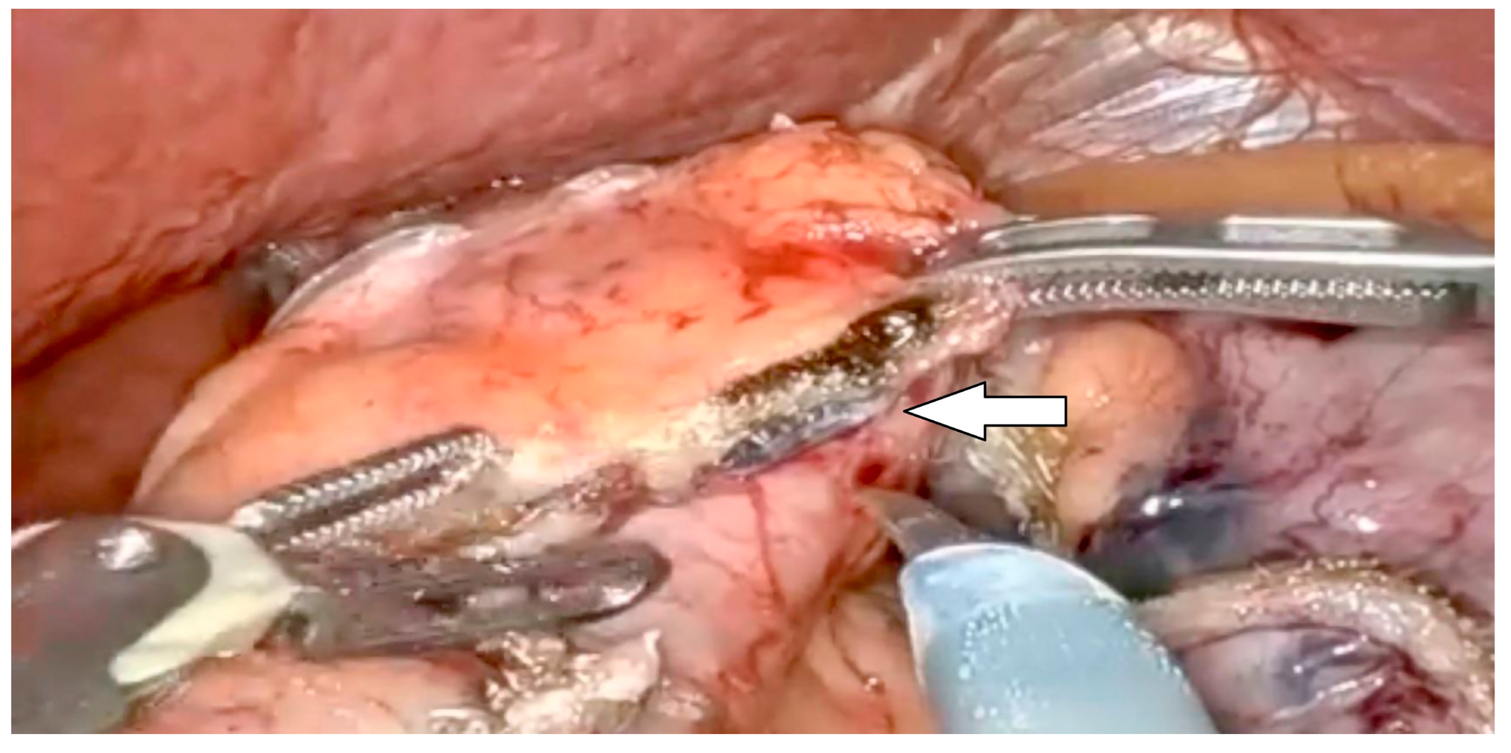 Jcm 13 04456 g002 Jcm 13 04456 g002