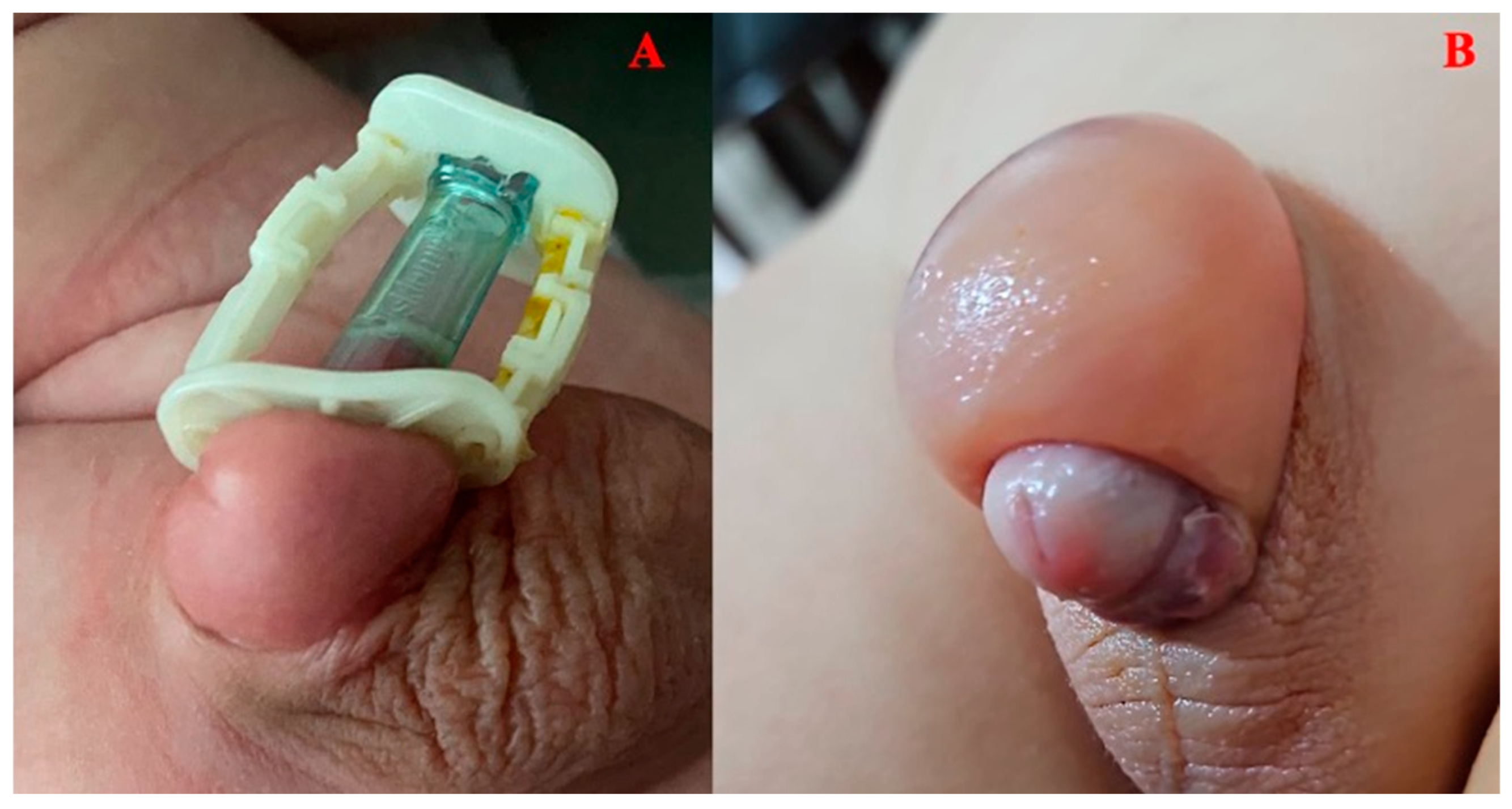 Jcm 13 04568 g005 Jcm 13 04568 g005