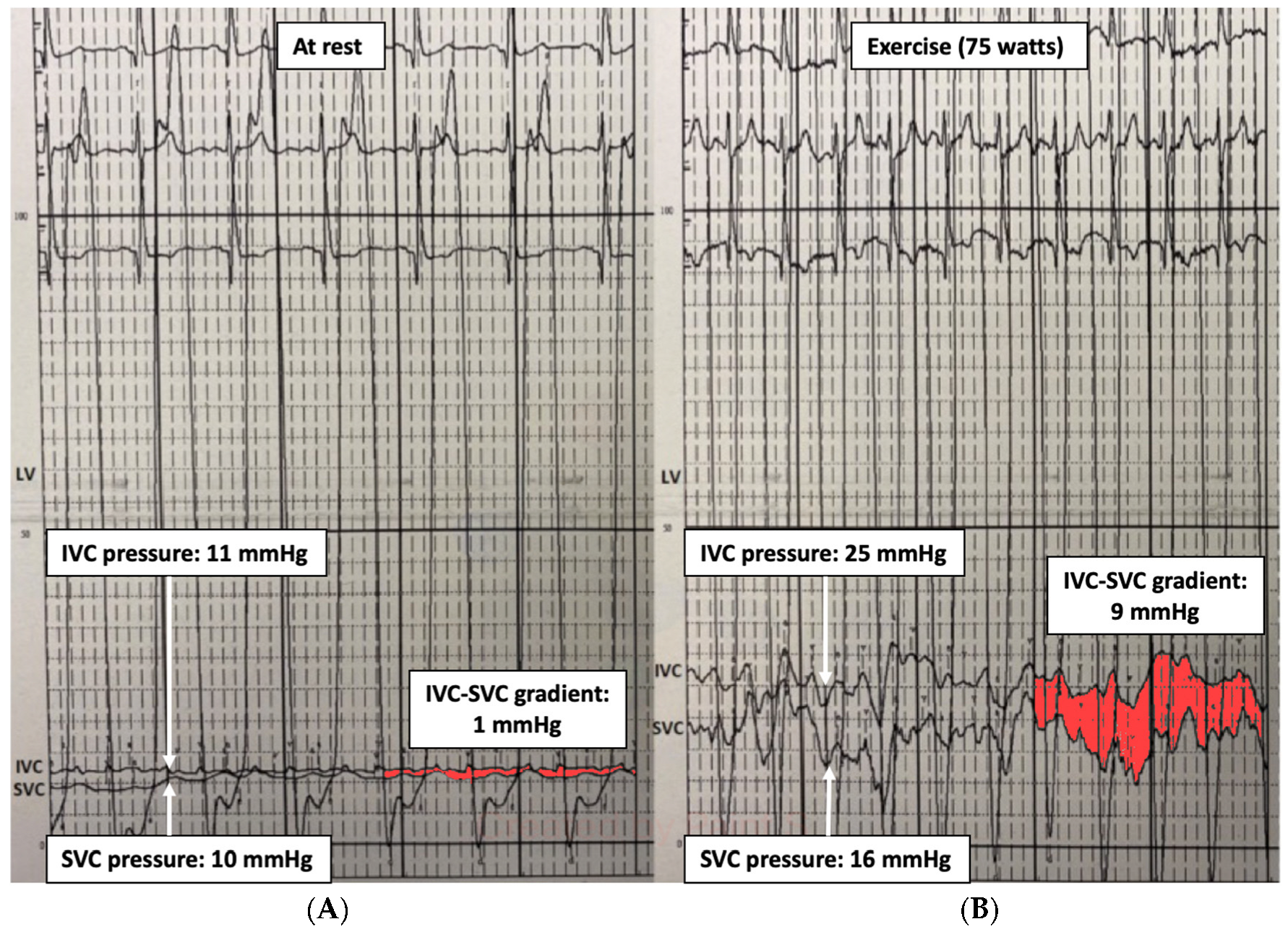 Jcm 13 04633 g002 Jcm 13 04633 g002
