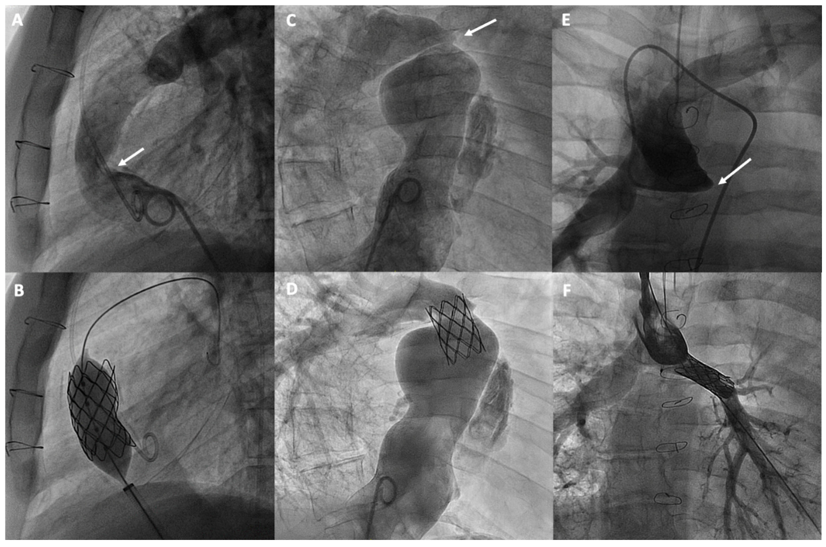 Jcm 13 04633 g004 Jcm 13 04633 g004