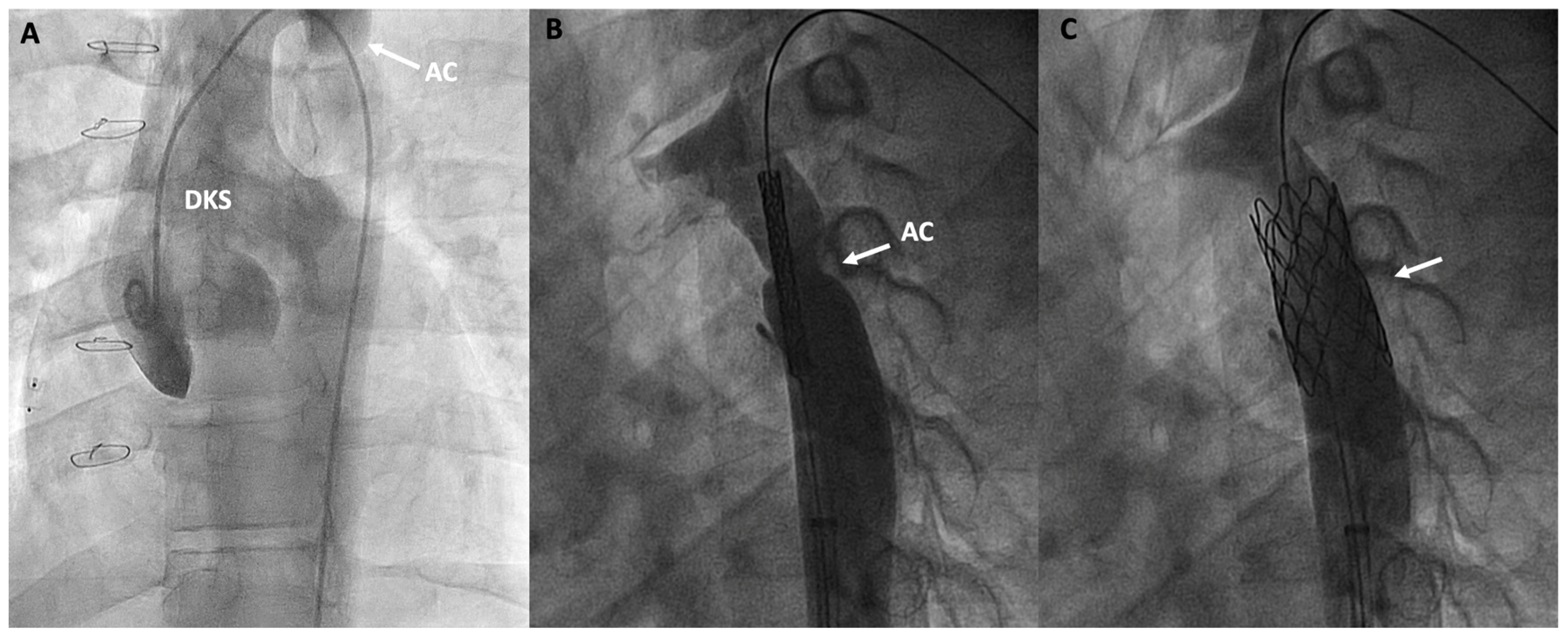 Jcm 13 04633 g007 Jcm 13 04633 g007