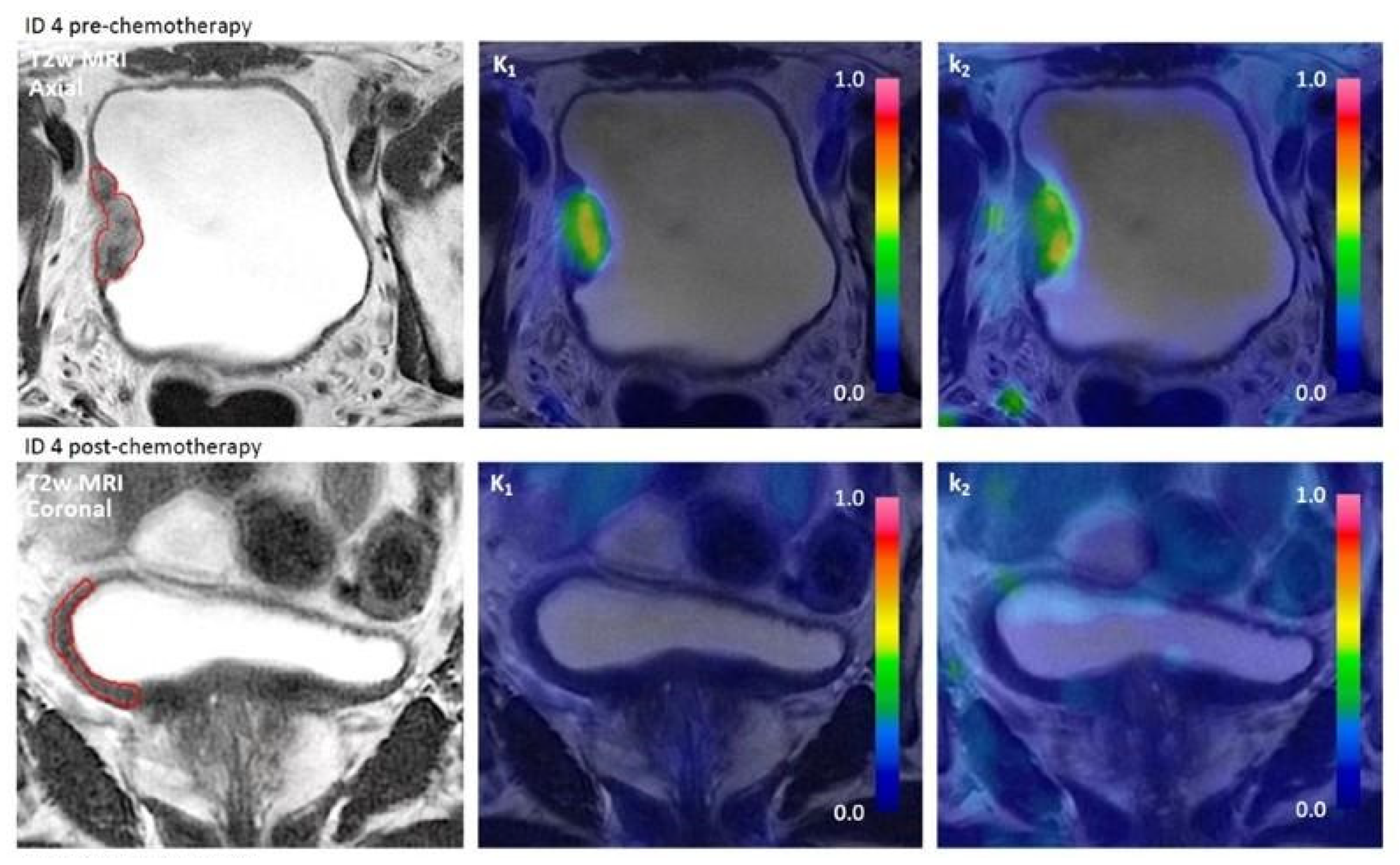 Jcm 13 04652 g002a Jcm 13 04652 g002a