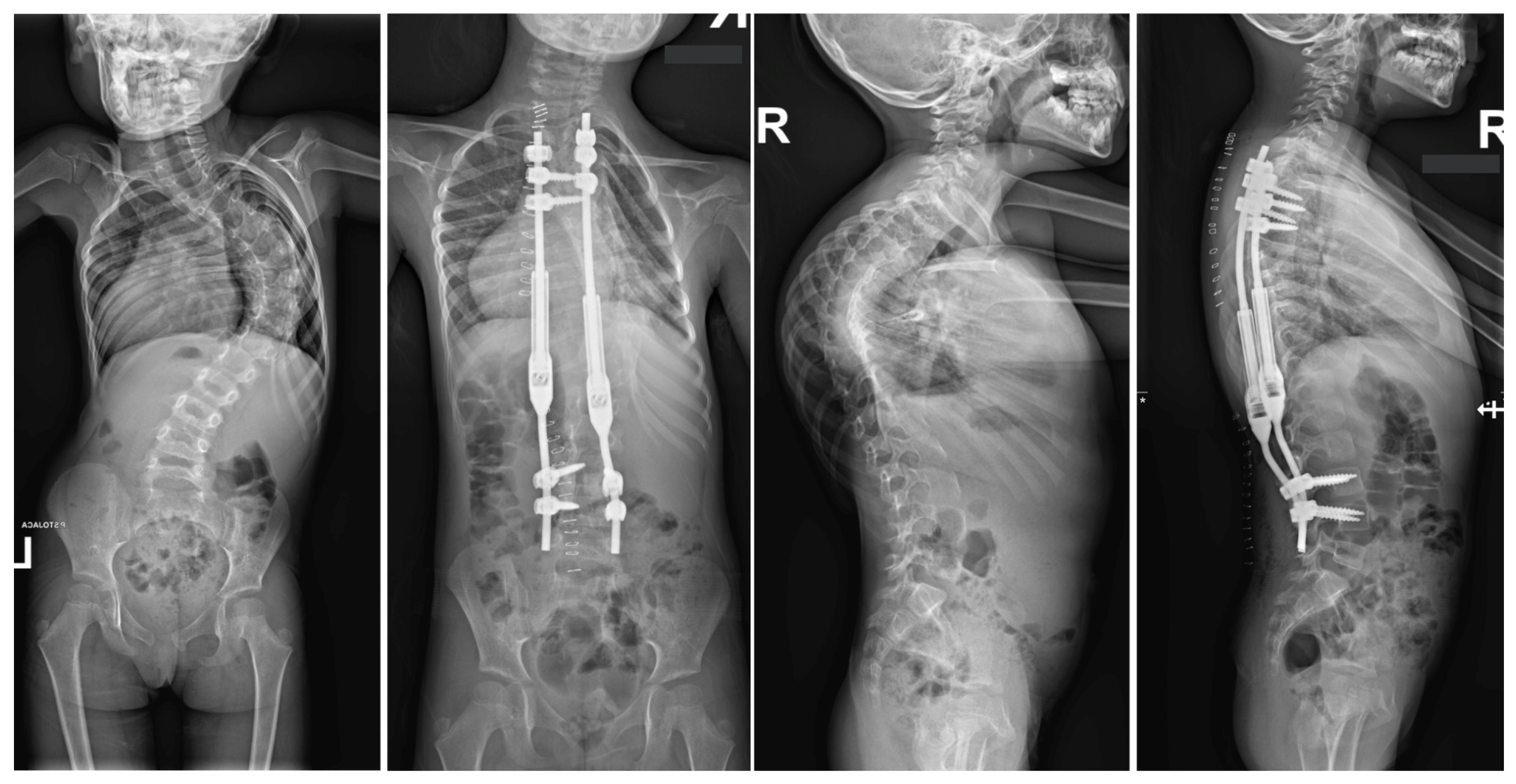 Jcm 13 04824 g003a Jcm 13 04824 g003a