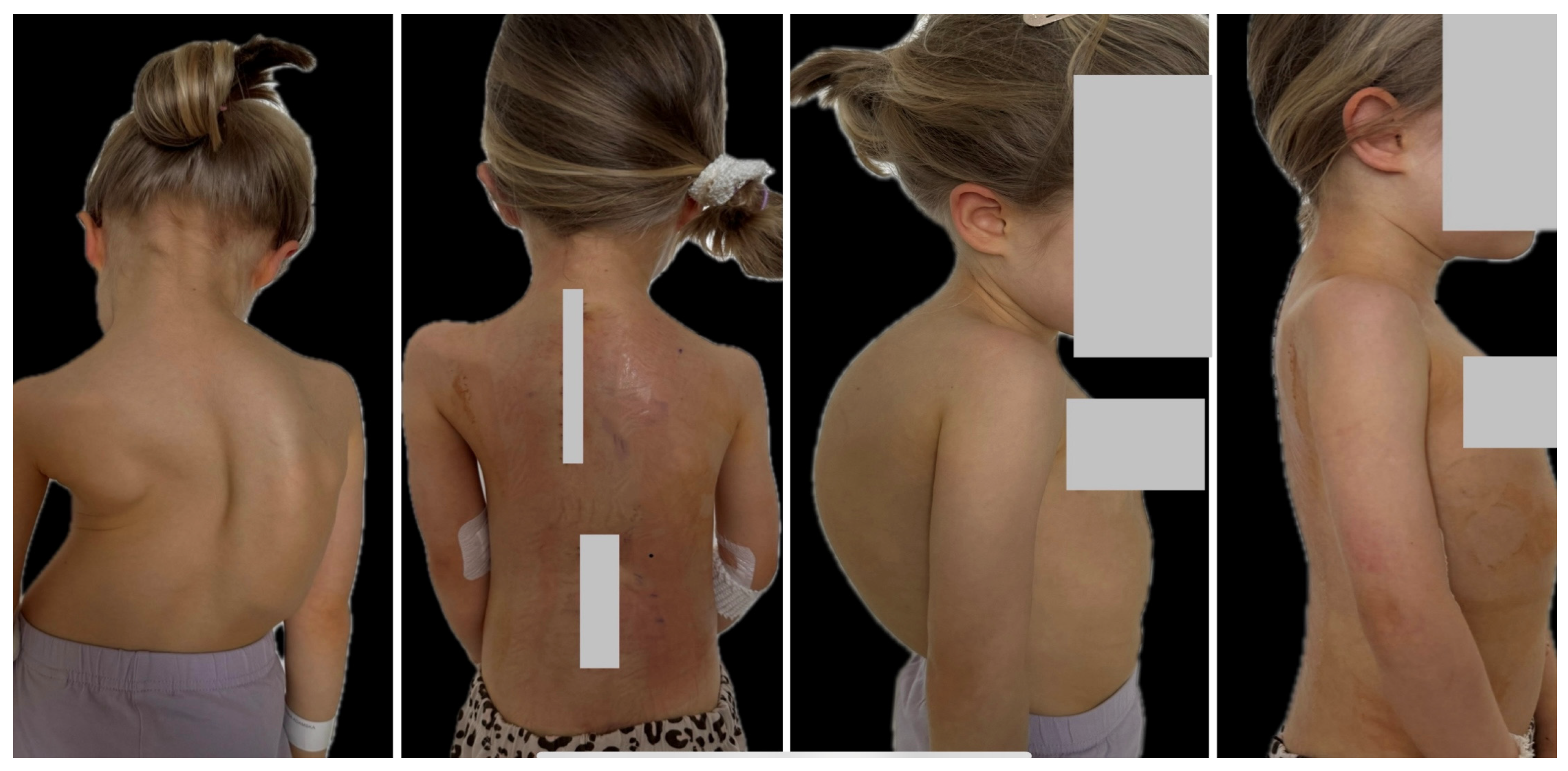 Jcm 13 04824 g003b Jcm 13 04824 g003b