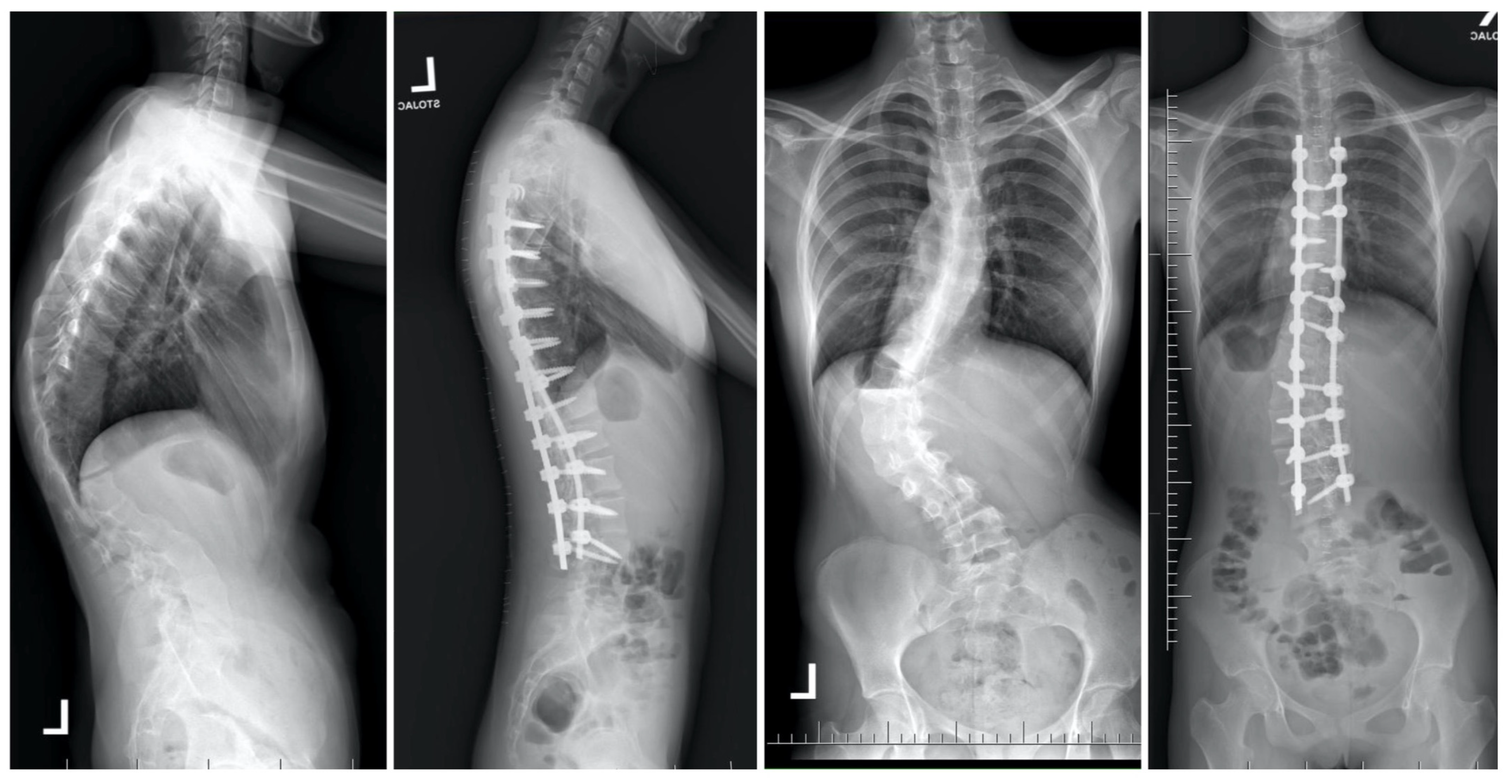 Jcm 13 04824 g004 Jcm 13 04824 g004