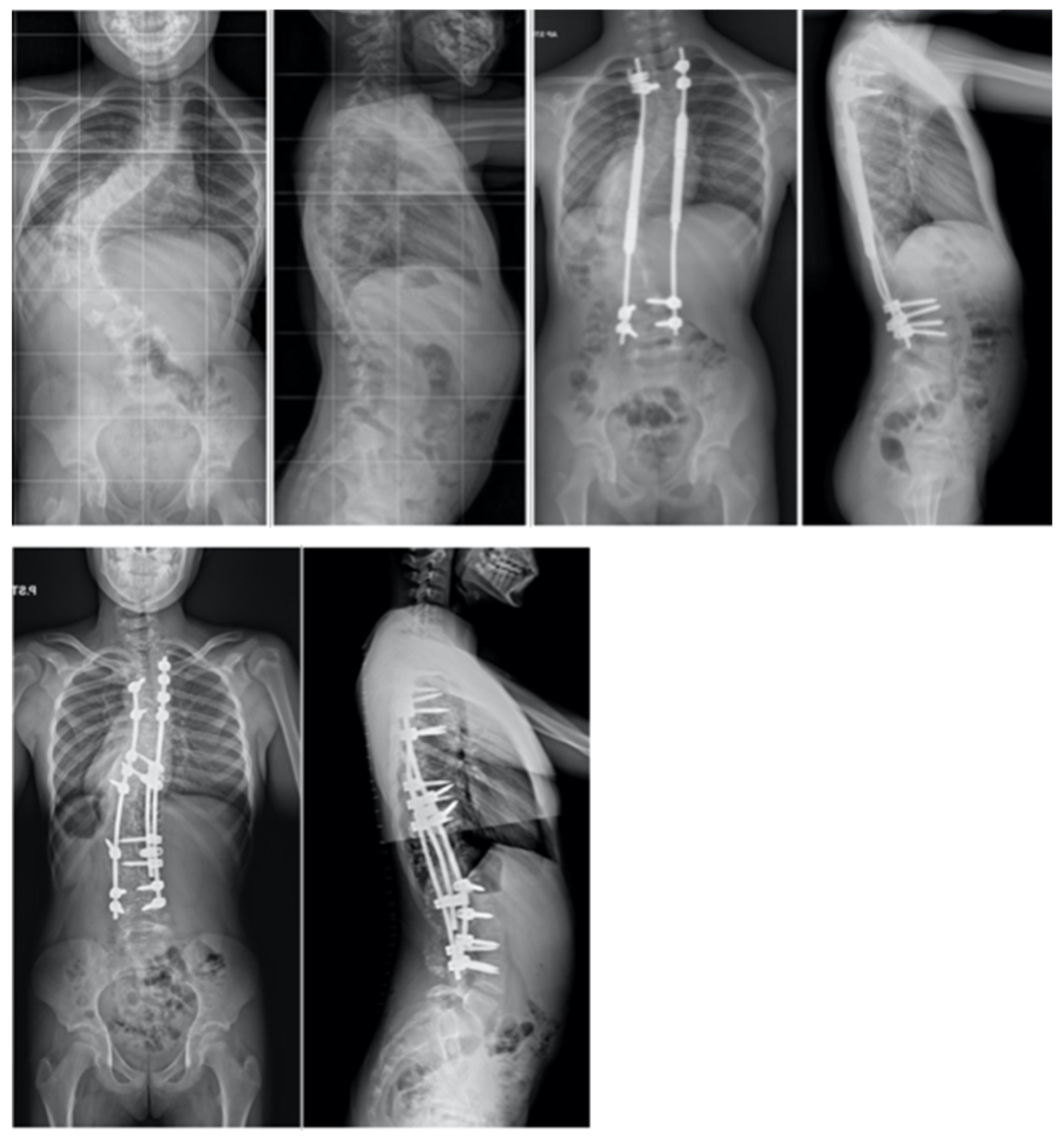 Jcm 13 04824 g005 Jcm 13 04824 g005