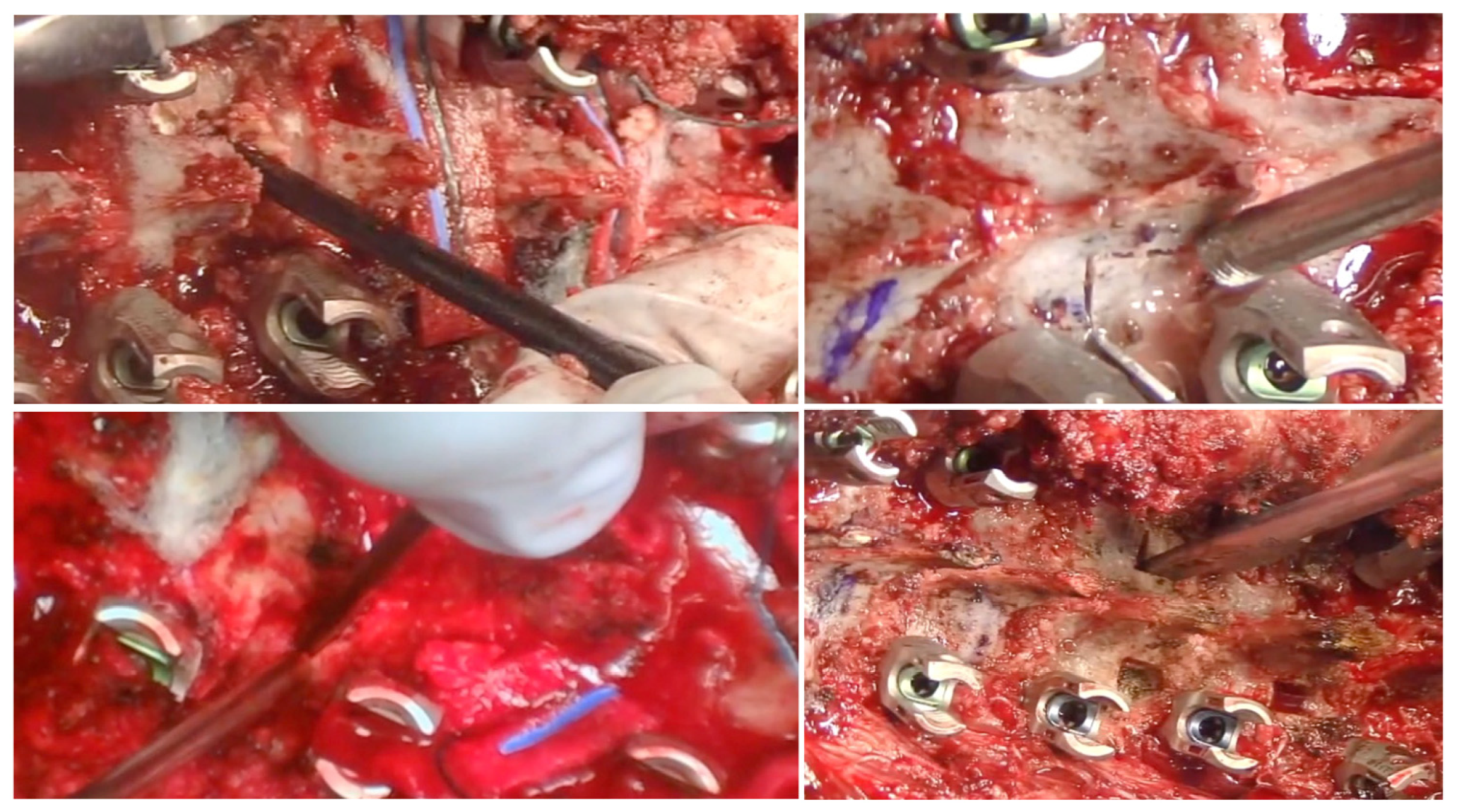 Jcm 13 04824 g008 Jcm 13 04824 g008