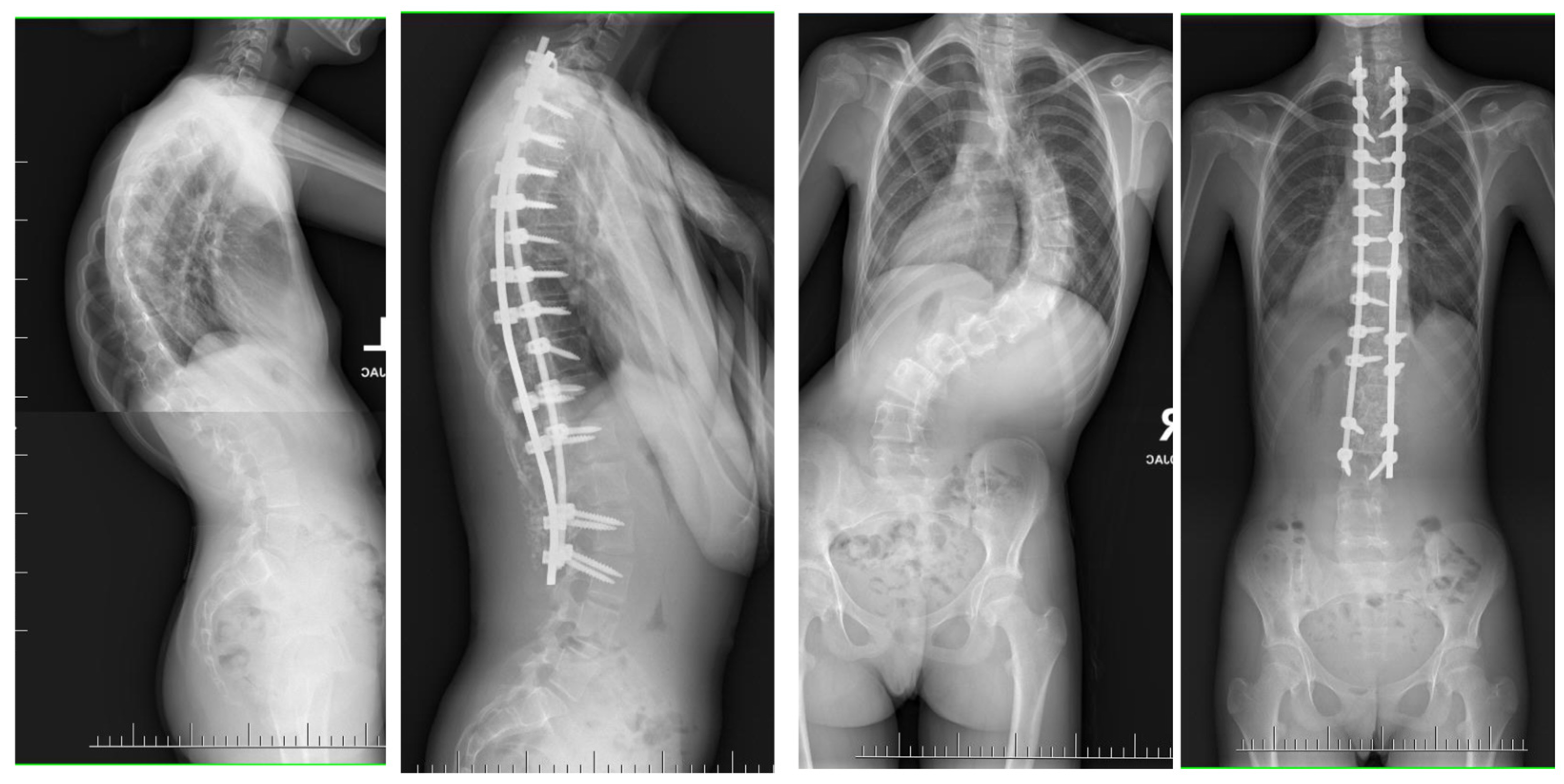 Jcm 13 04824 g009 Jcm 13 04824 g009