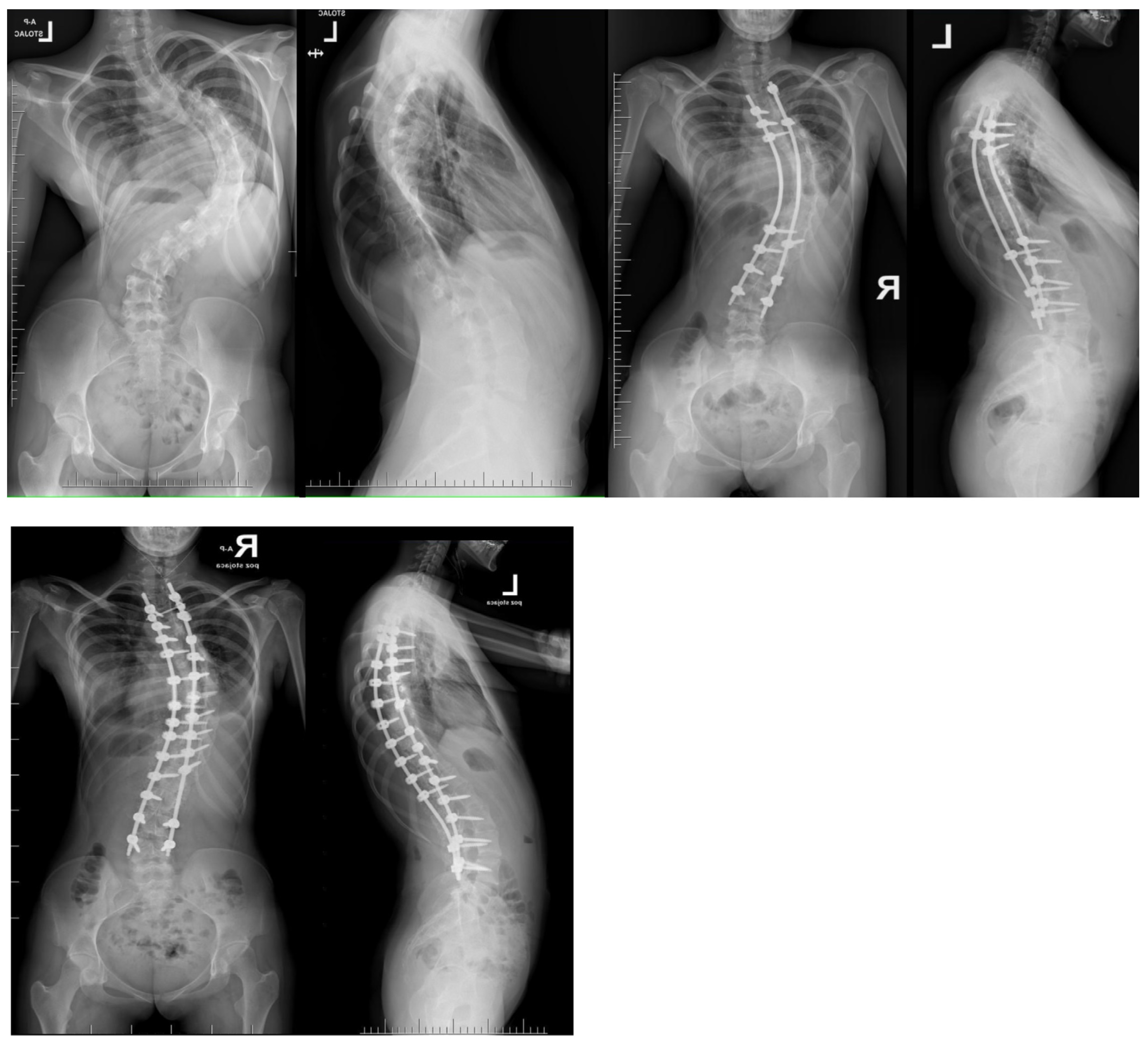 Jcm 13 04824 g010 Jcm 13 04824 g010
