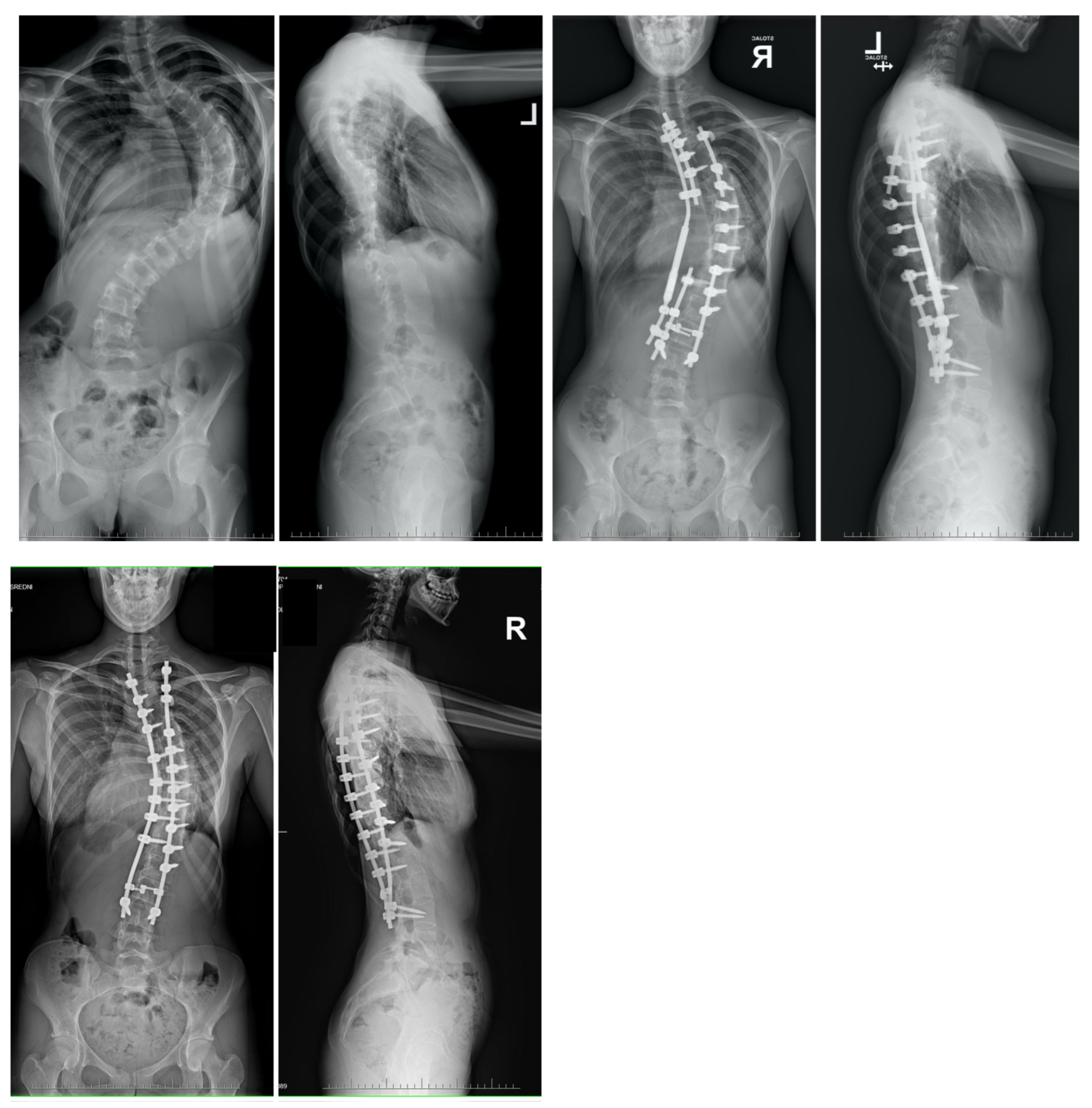 Jcm 13 04824 g011 Jcm 13 04824 g011
