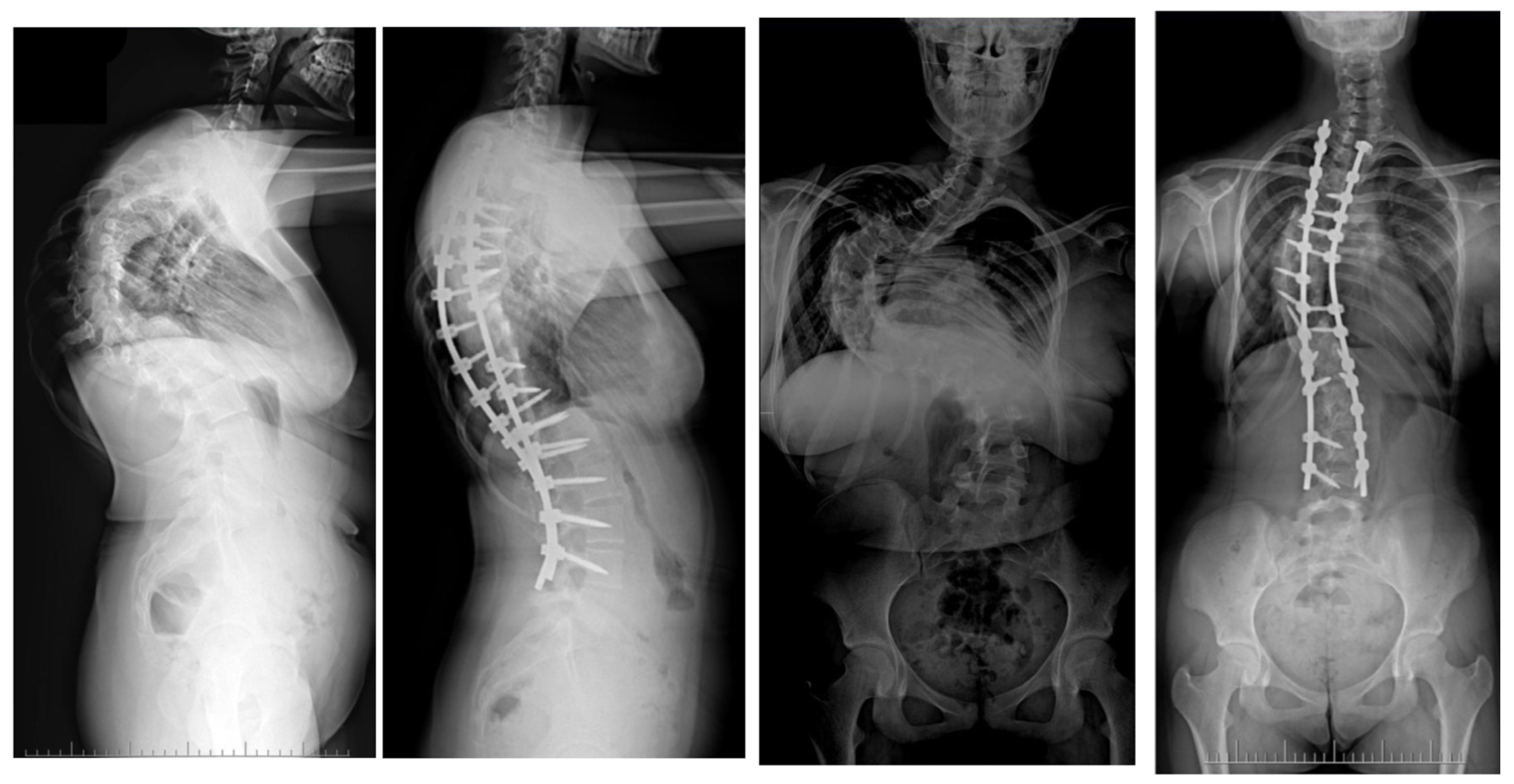 Jcm 13 04824 g012 Jcm 13 04824 g012