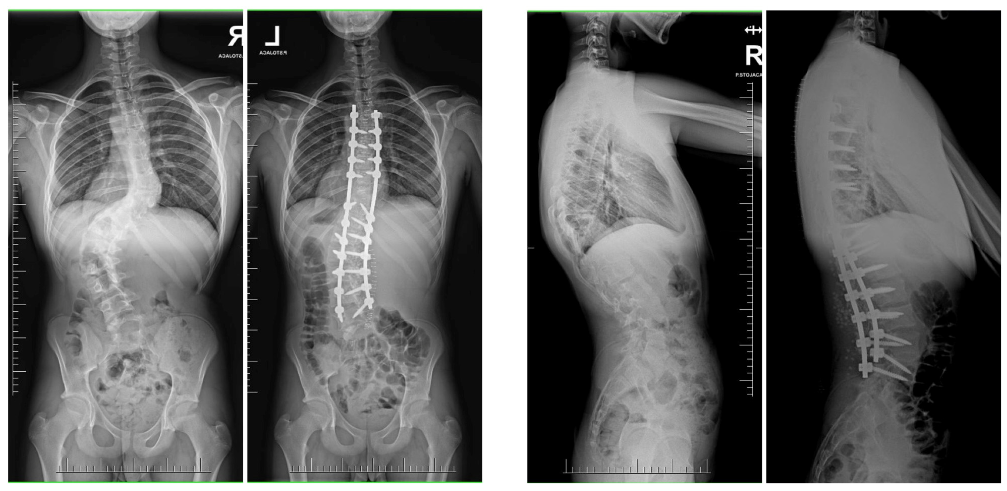 Jcm 13 04824 g013 Jcm 13 04824 g013