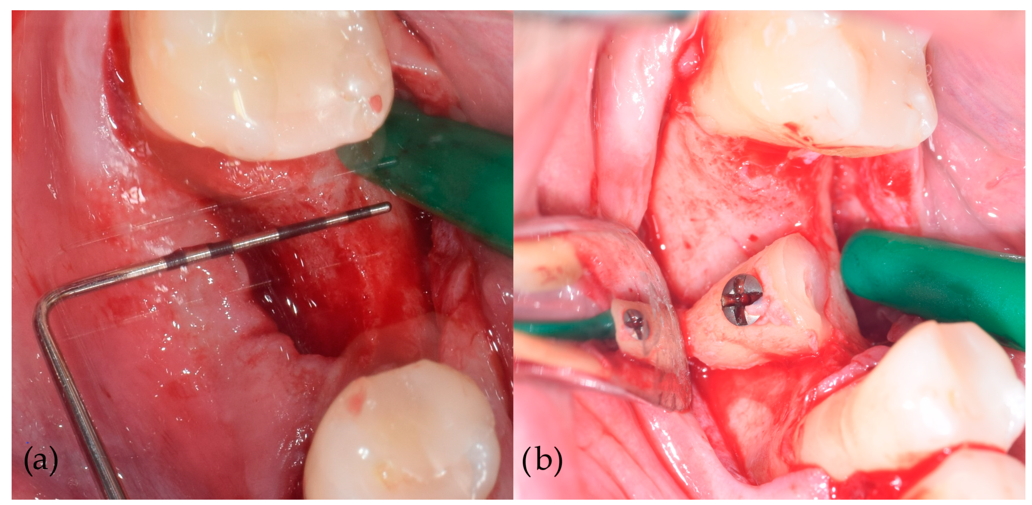 Jcm 13 05118 g002 Jcm 13 05118 g002