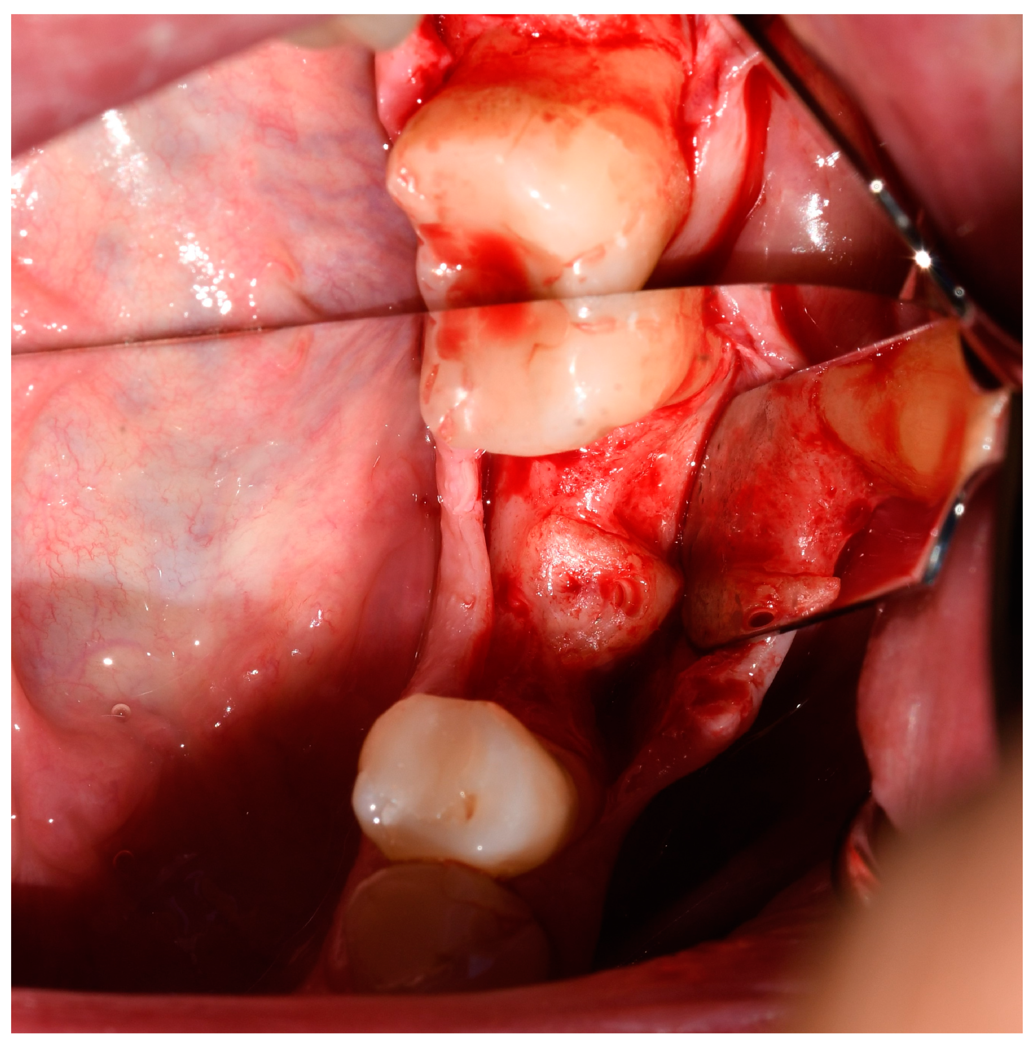 Jcm 13 05118 g003 Jcm 13 05118 g003