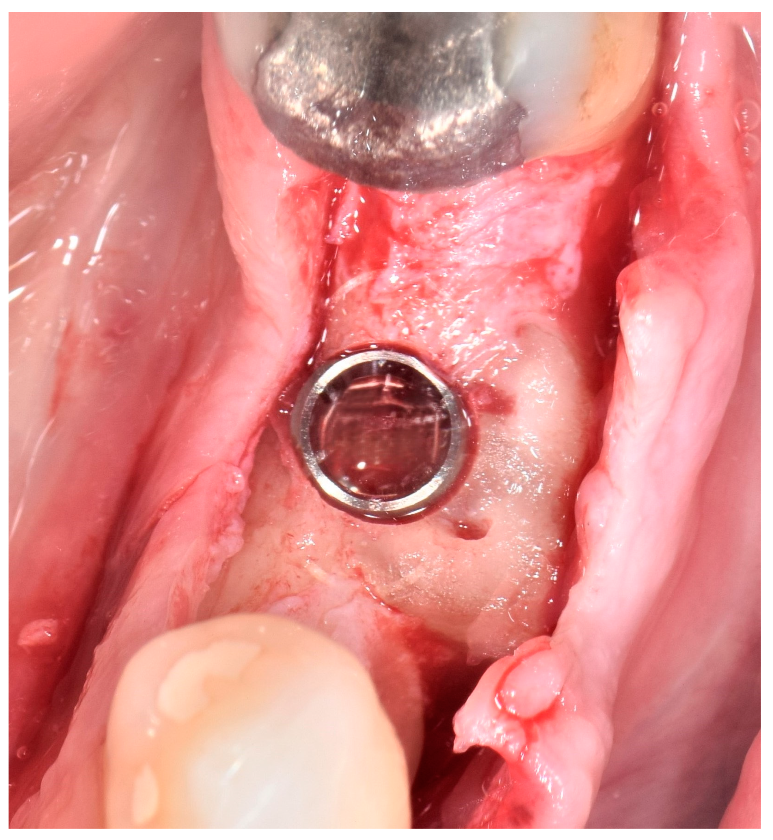 Jcm 13 05118 g004 Jcm 13 05118 g004