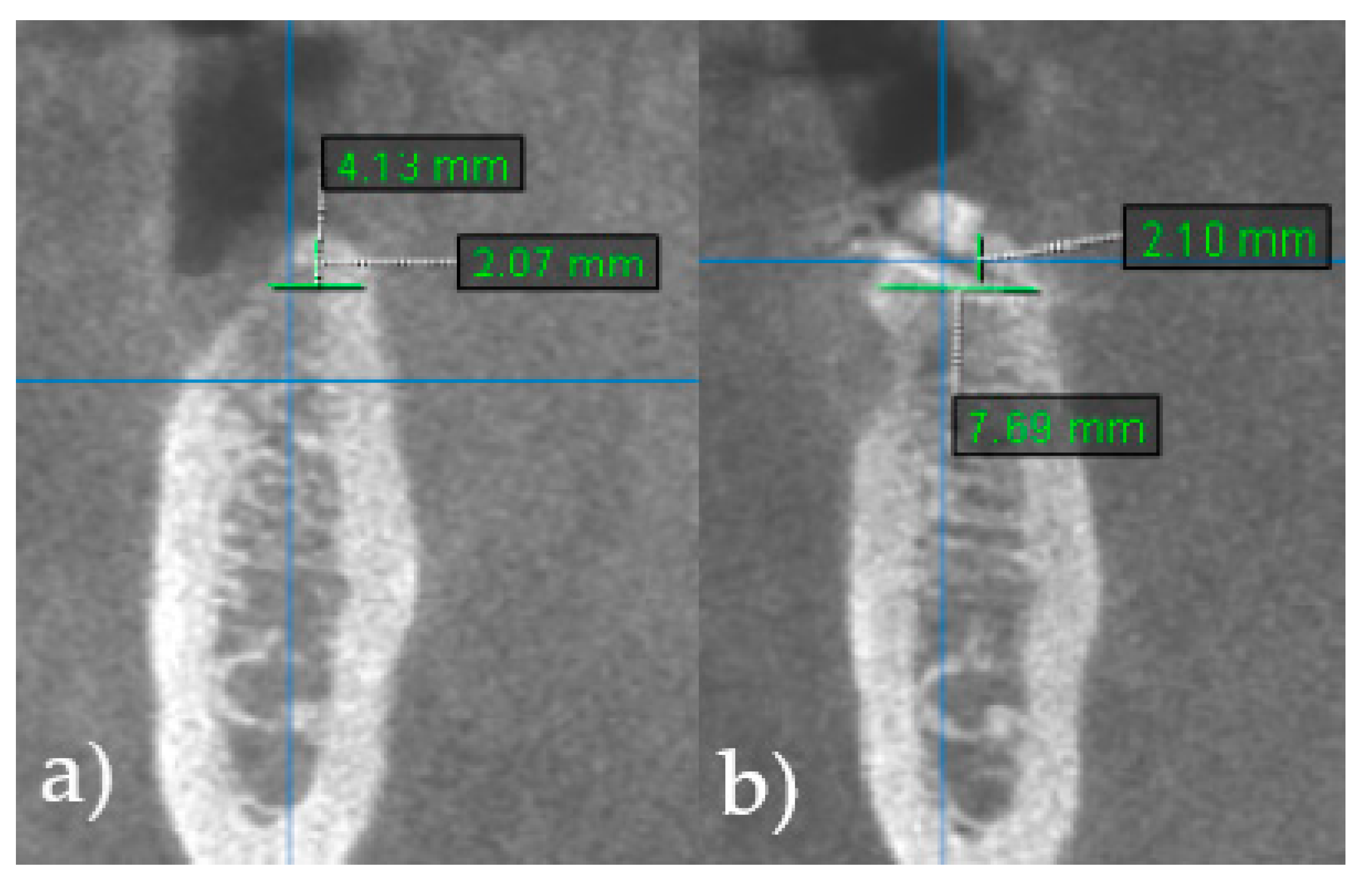 Jcm 13 05118 g005 Jcm 13 05118 g005